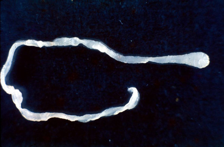 Doctors remove live 10-inch tapeworm during hernia surgery