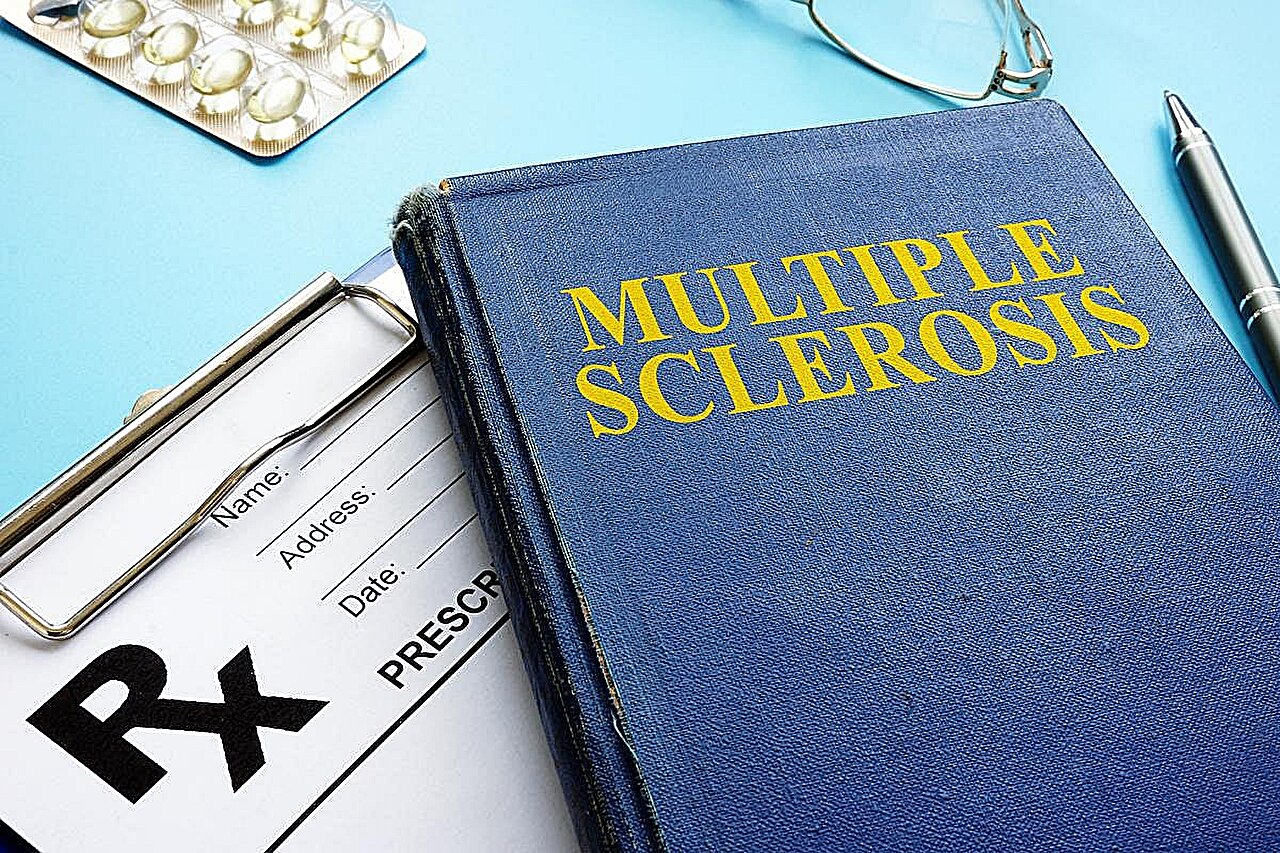 Black MS patients dying younger in national mortality study