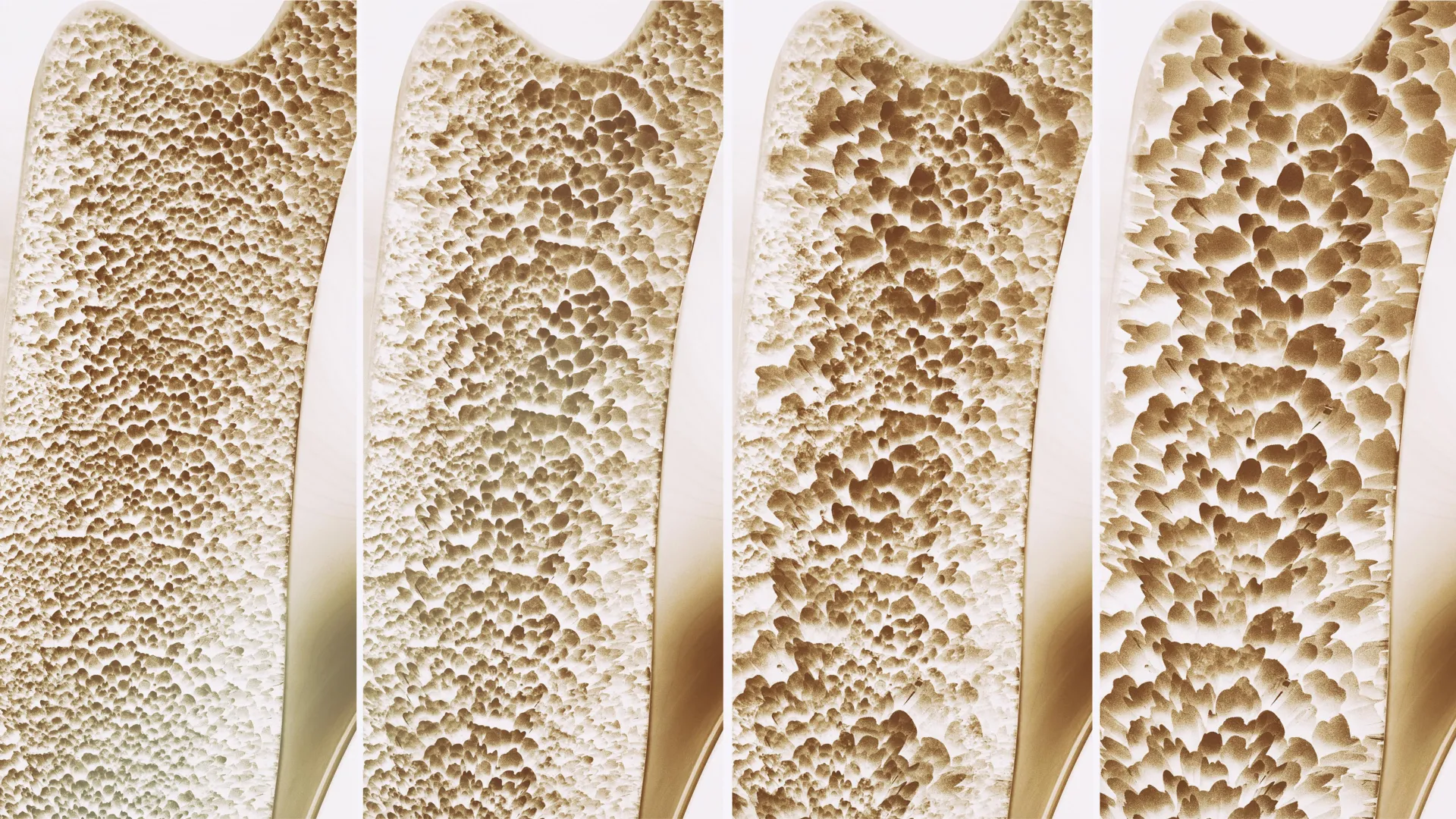 Review finds supplements offer little fall or fracture protection