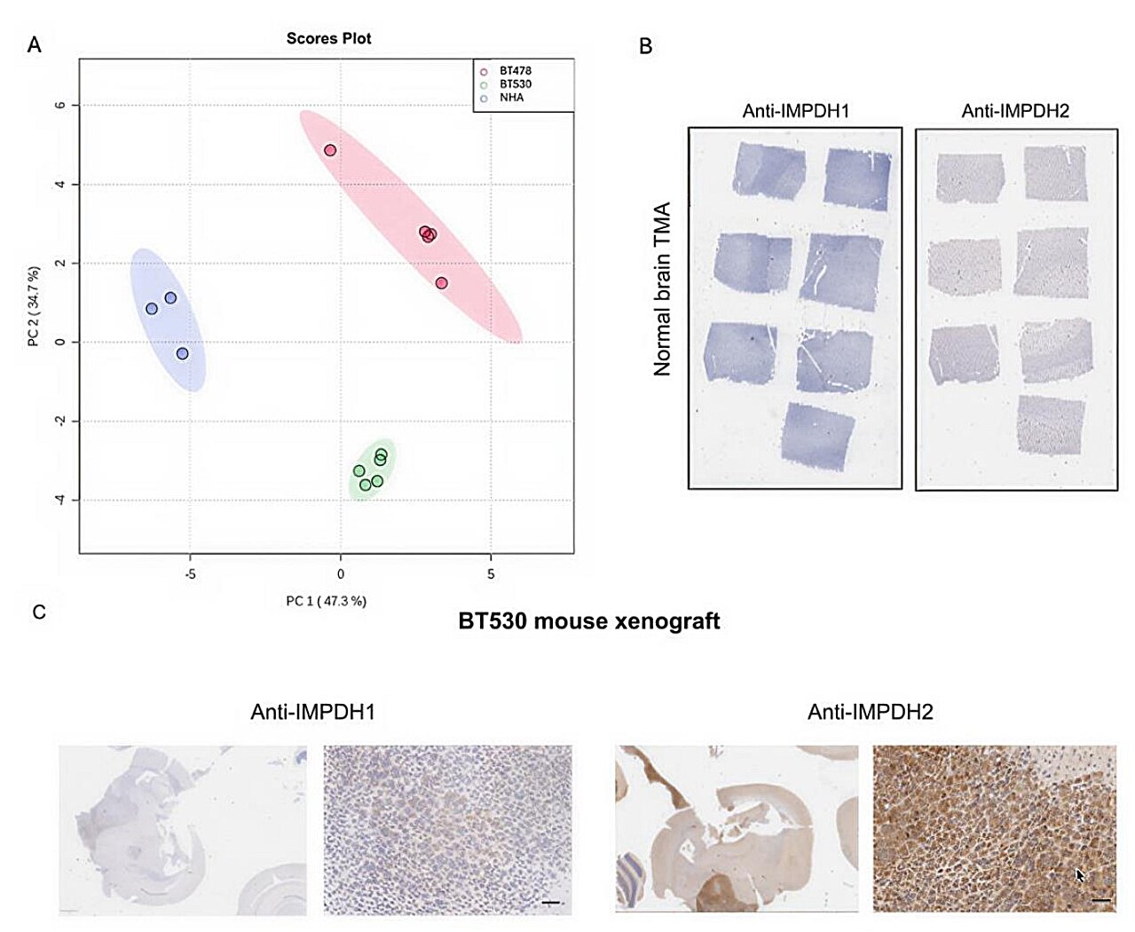 Drug candidates target enzyme tied to cancer spread to the brain