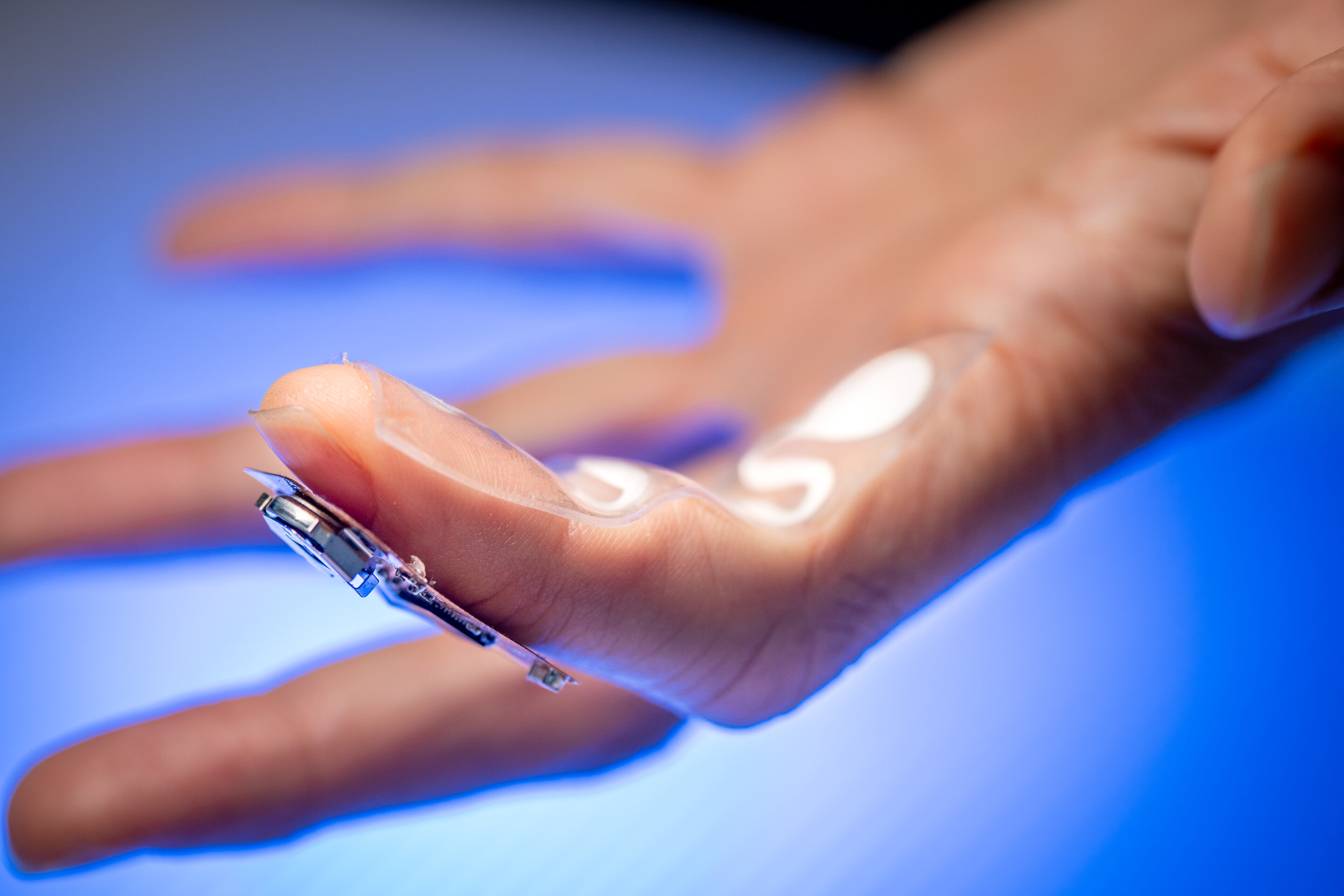 Parkinson medication patch tracks levodopa in fingertip sweat