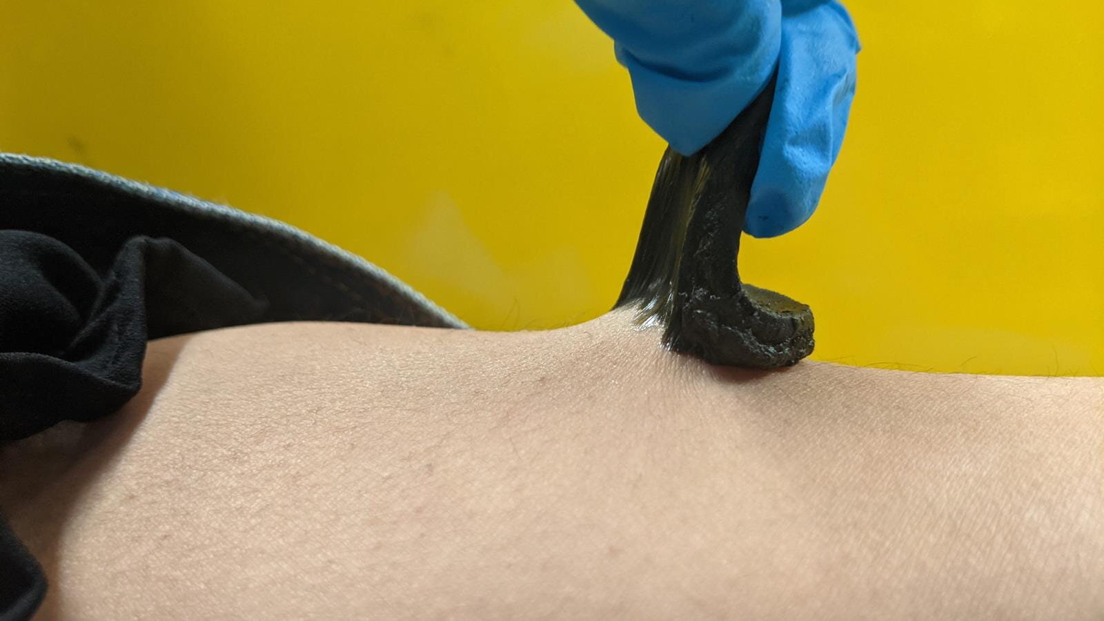 Hydrogel biosensors study reports stickier sensors for hairy, sweaty skin