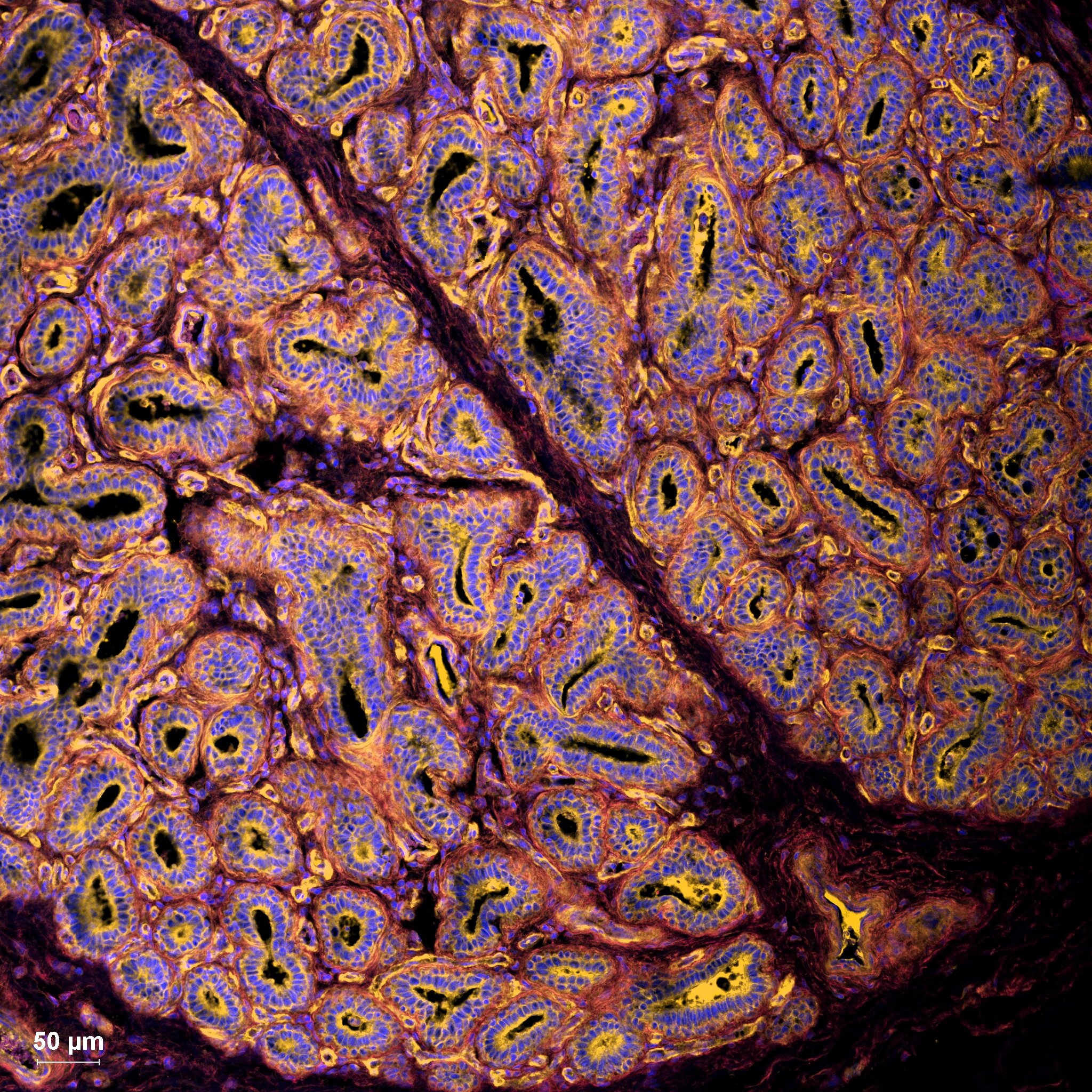 Study ties dairy cattle H5N1 infections to udder cell receptors