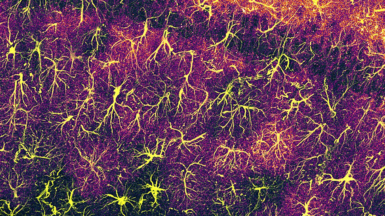 Study links star-shaped brain cells to memory persistence in mice