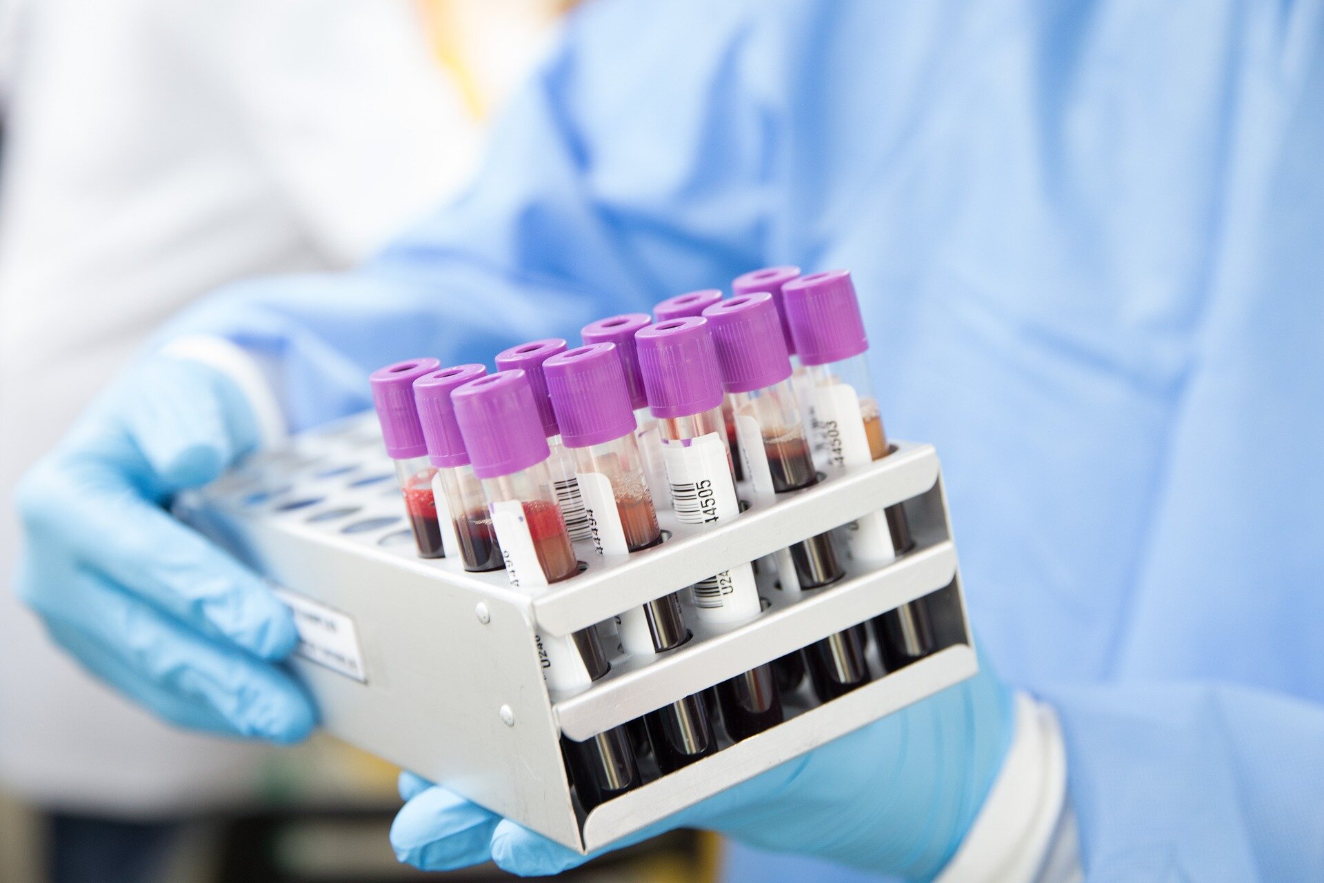 Cord blood CAR NK therapy study finds immature cells may weaken response