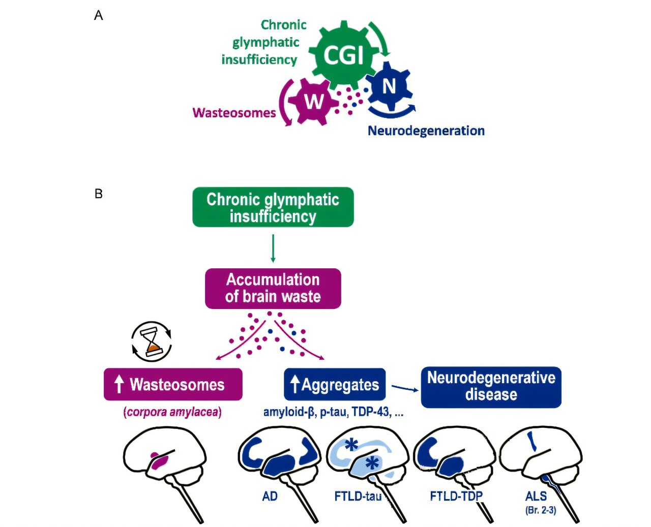 Wasteosomes in neurodegenerative diseases may signal poor brain clearance