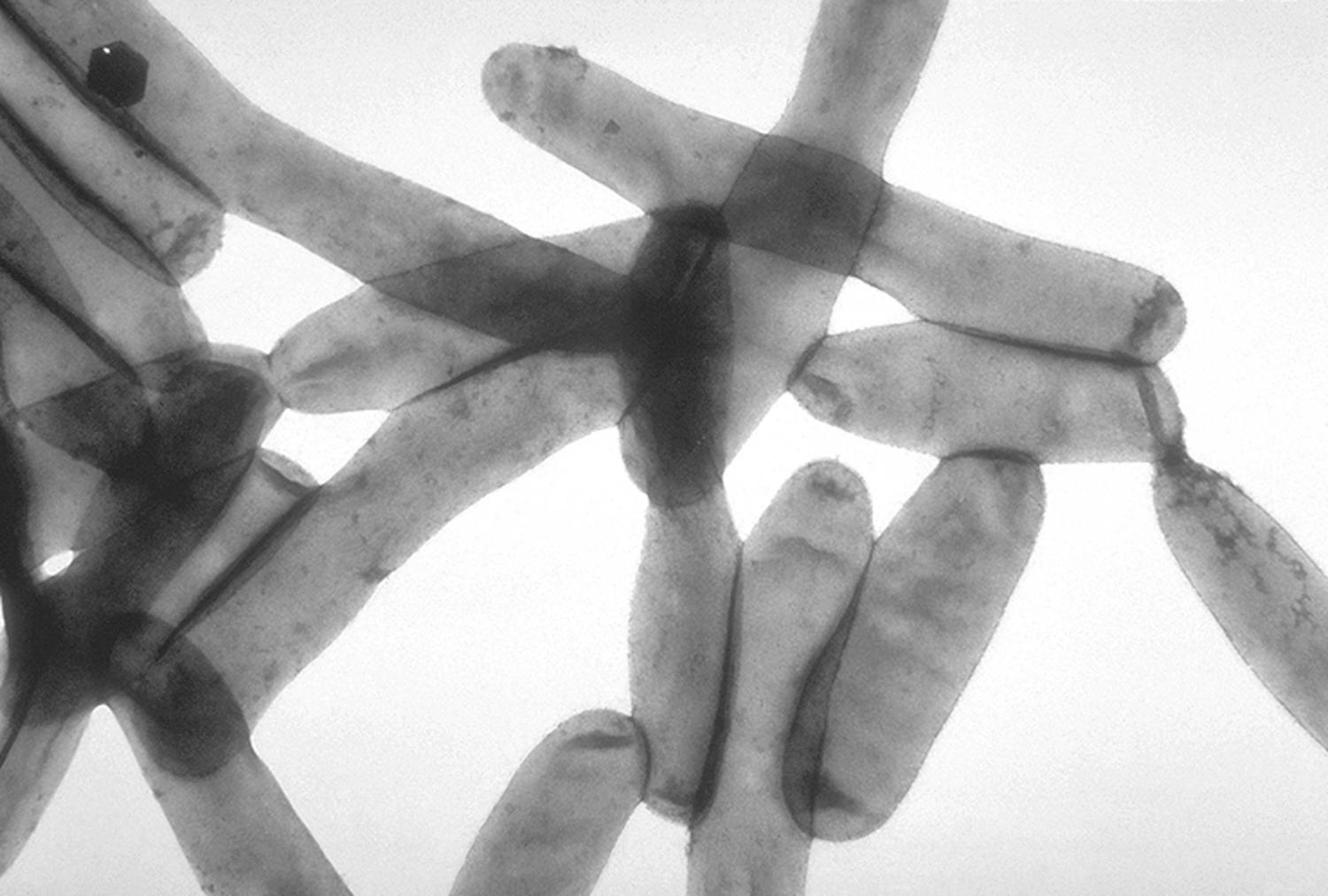 Legionnaires’ disease is understood, but outbreaks still recur