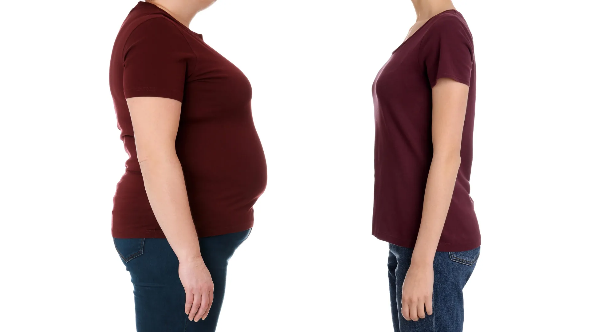 Cluster 5 diabetes risk persisted despite long-term weight loss, study finds
