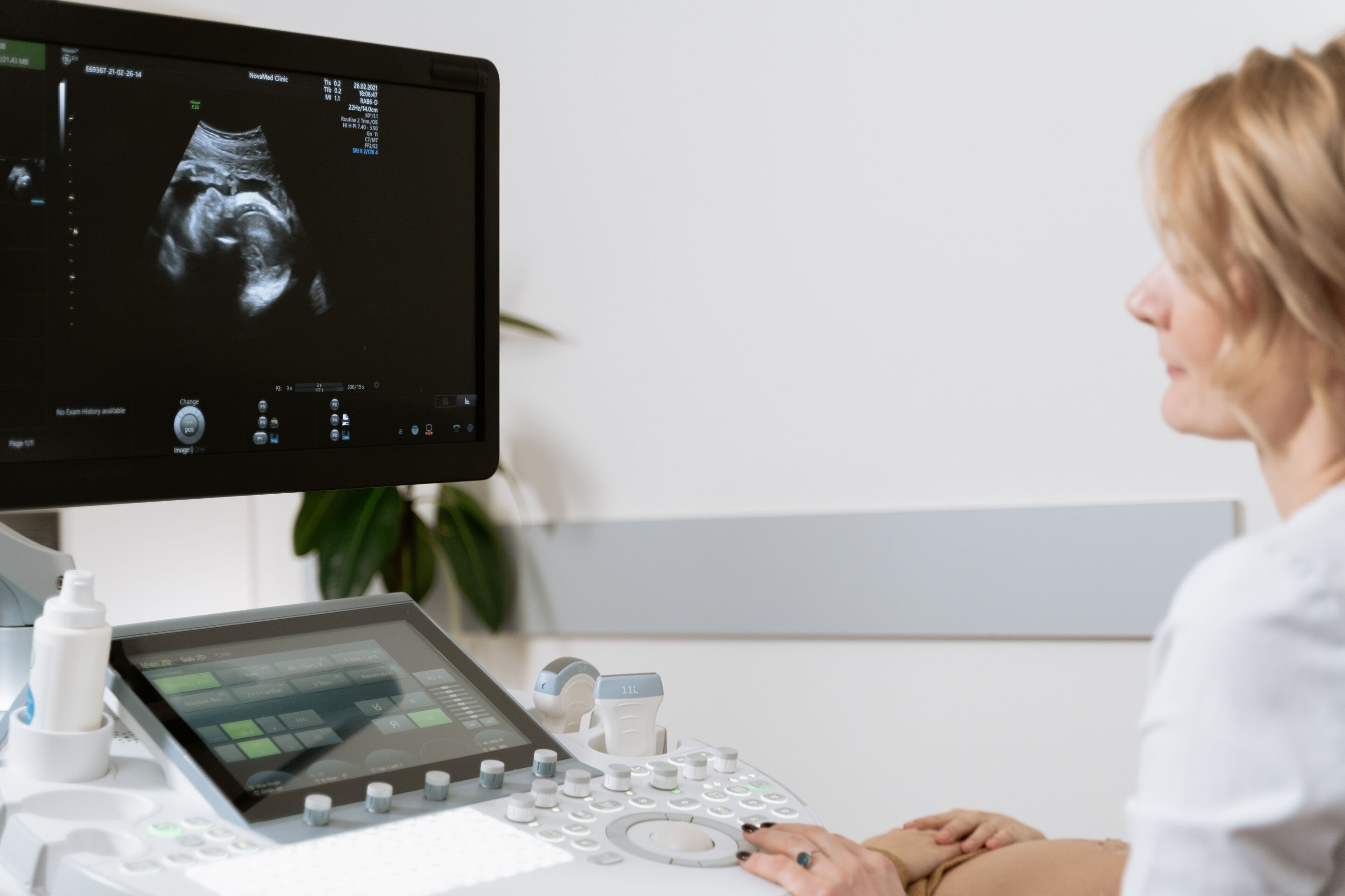 AI ultrasound imaging work at UVA targets clearer sonograms