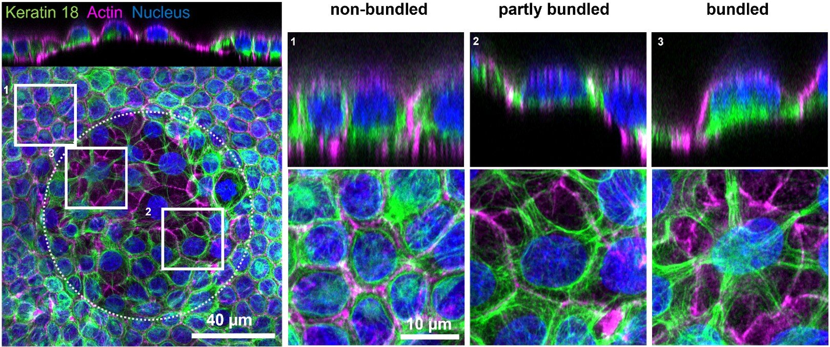 Prolonged stretching tissue cells can free nuclei from keratin cages