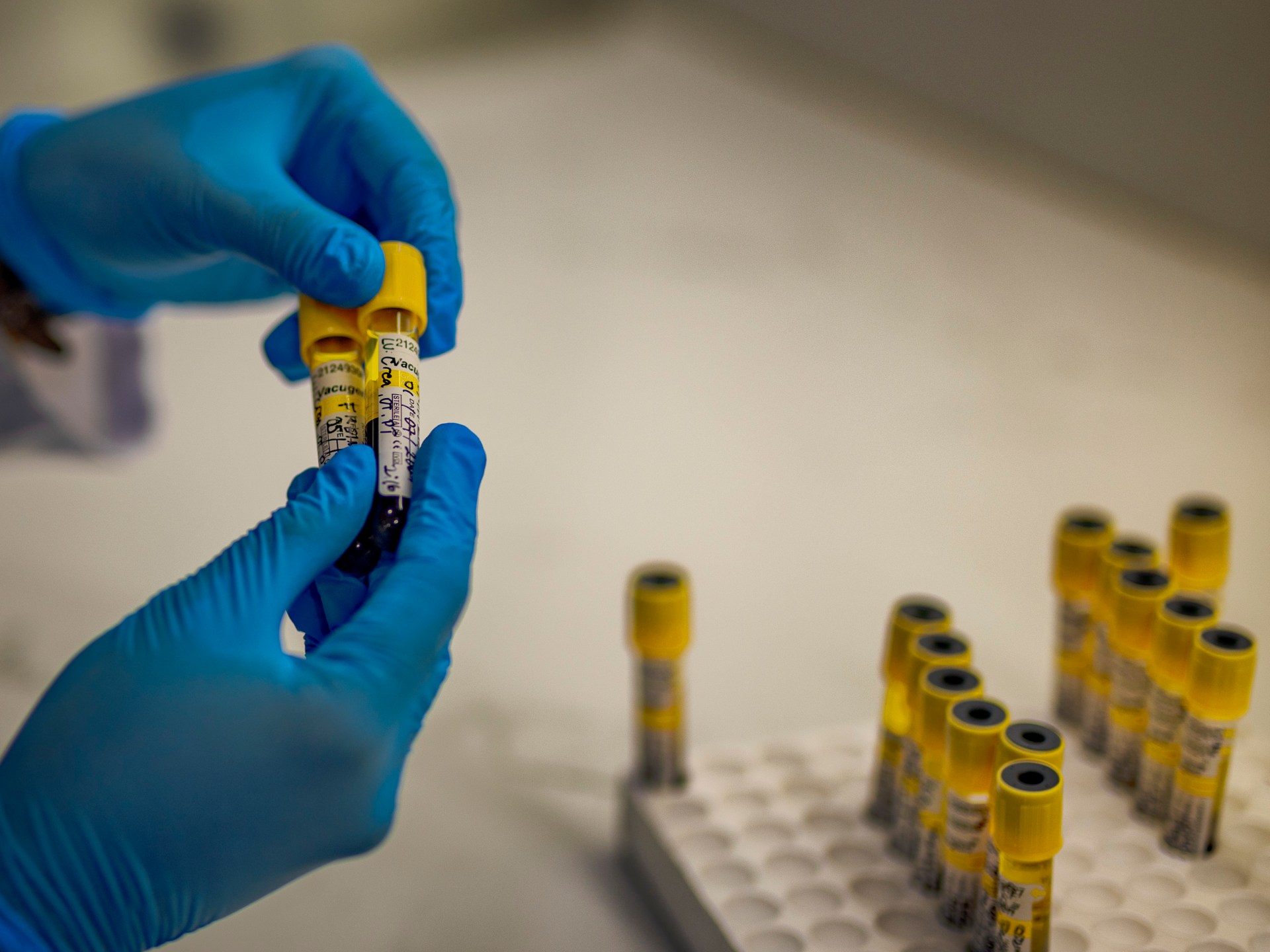 Funding cuts threaten progress against HIV in children
