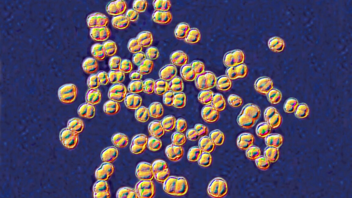 College lab meningitis exposure scare put 32 people on antibiotics