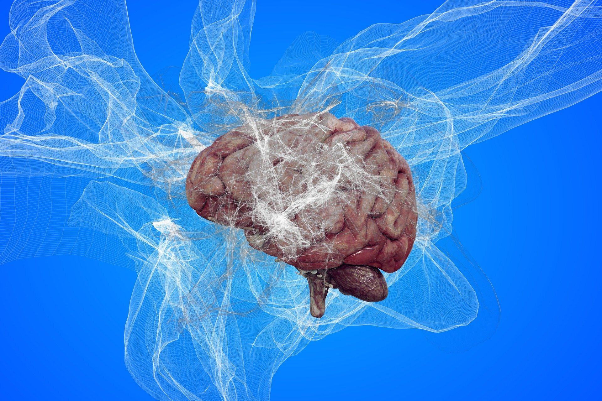 New analysis lowers Alzheimer’s risk estimate for Japanese APOE-e4 homozygotes