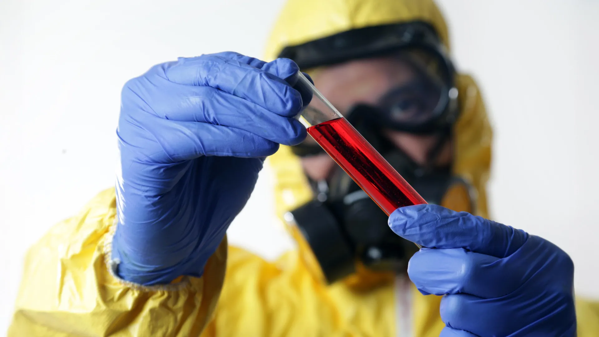 Doctors warned to watch for Ebola and hantavirus as flu-like symptoms emerge