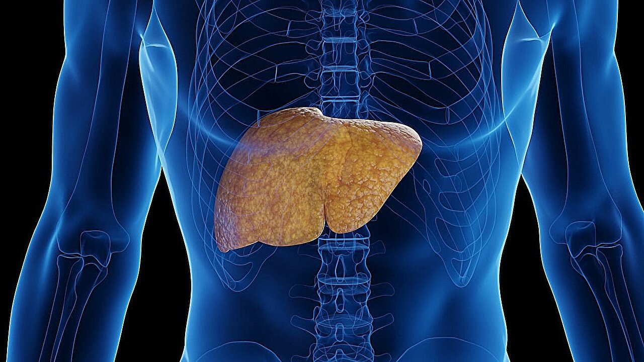 Poor sleep tied to higher fatty liver risk in type 2 diabetes
