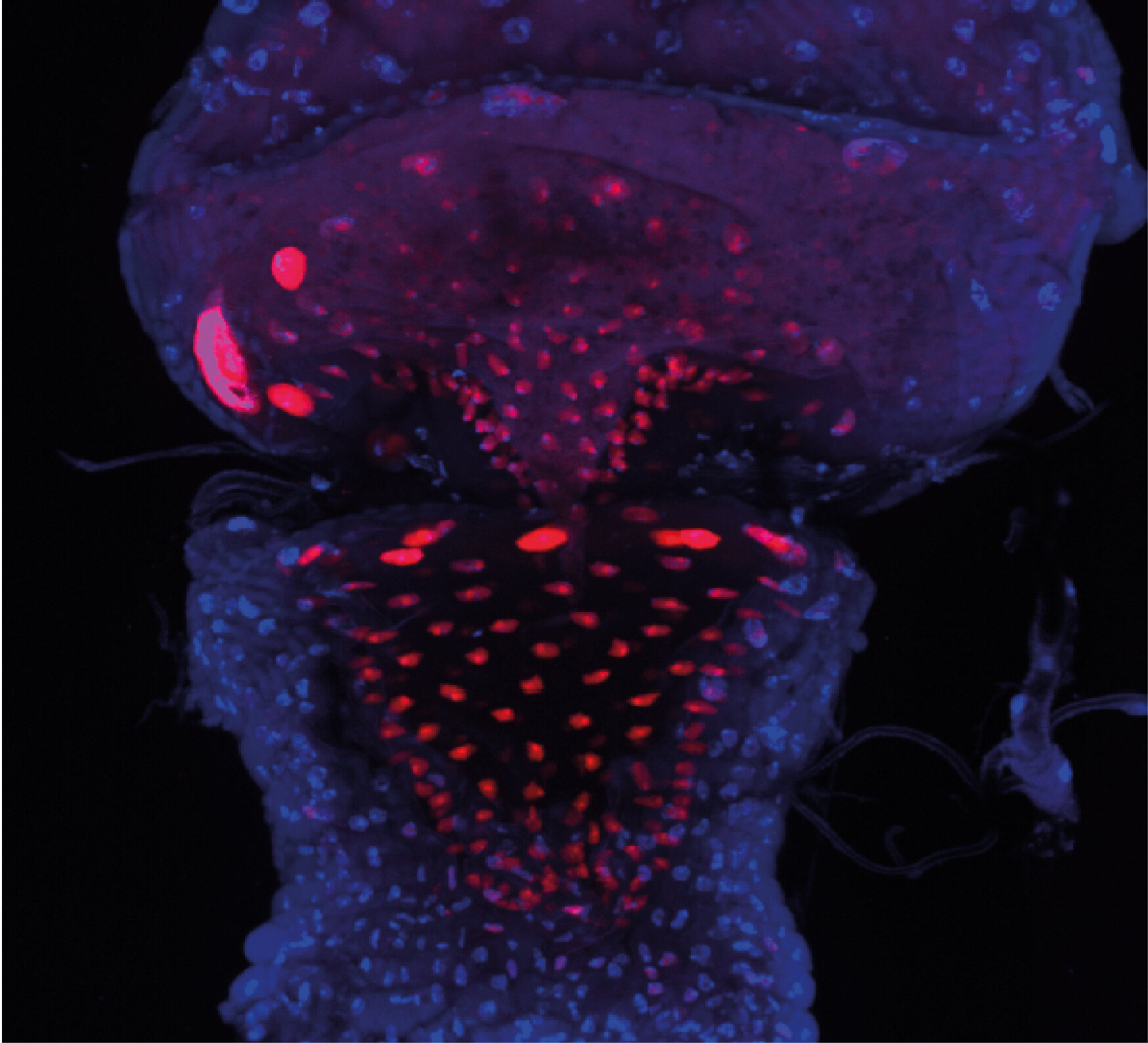 Blocked gut makes newborn fruit flies sleep rather than eat