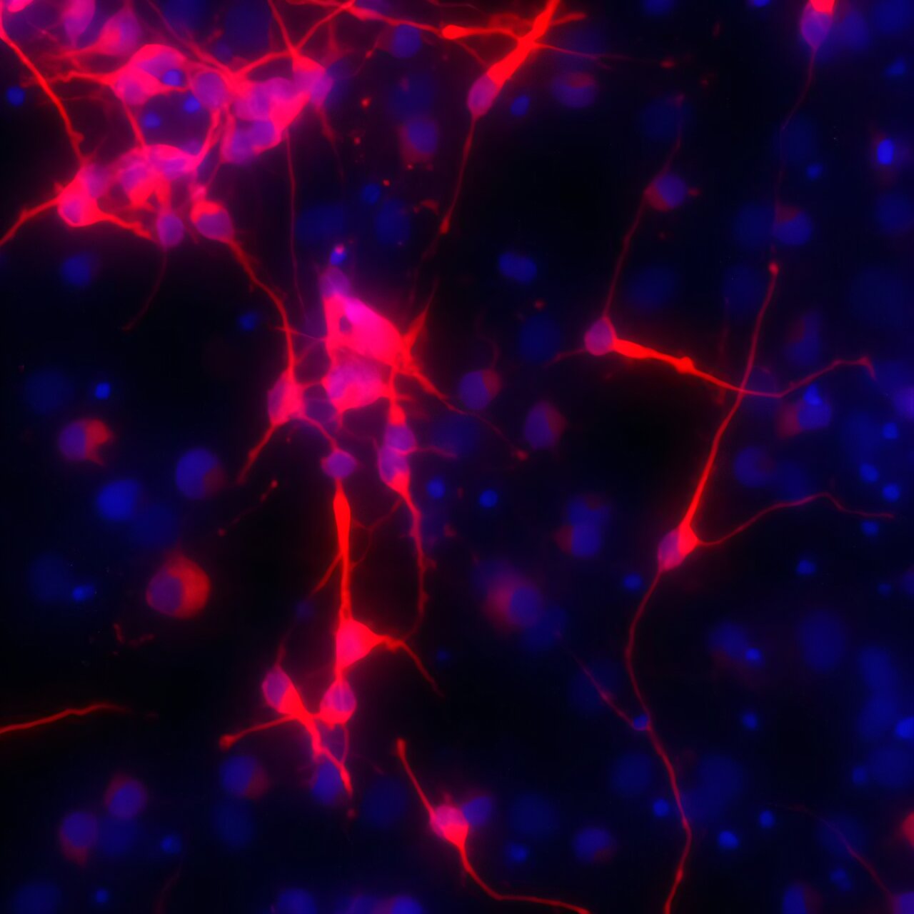 Prenatal fructose exposure tied to brain stem cell changes in rats