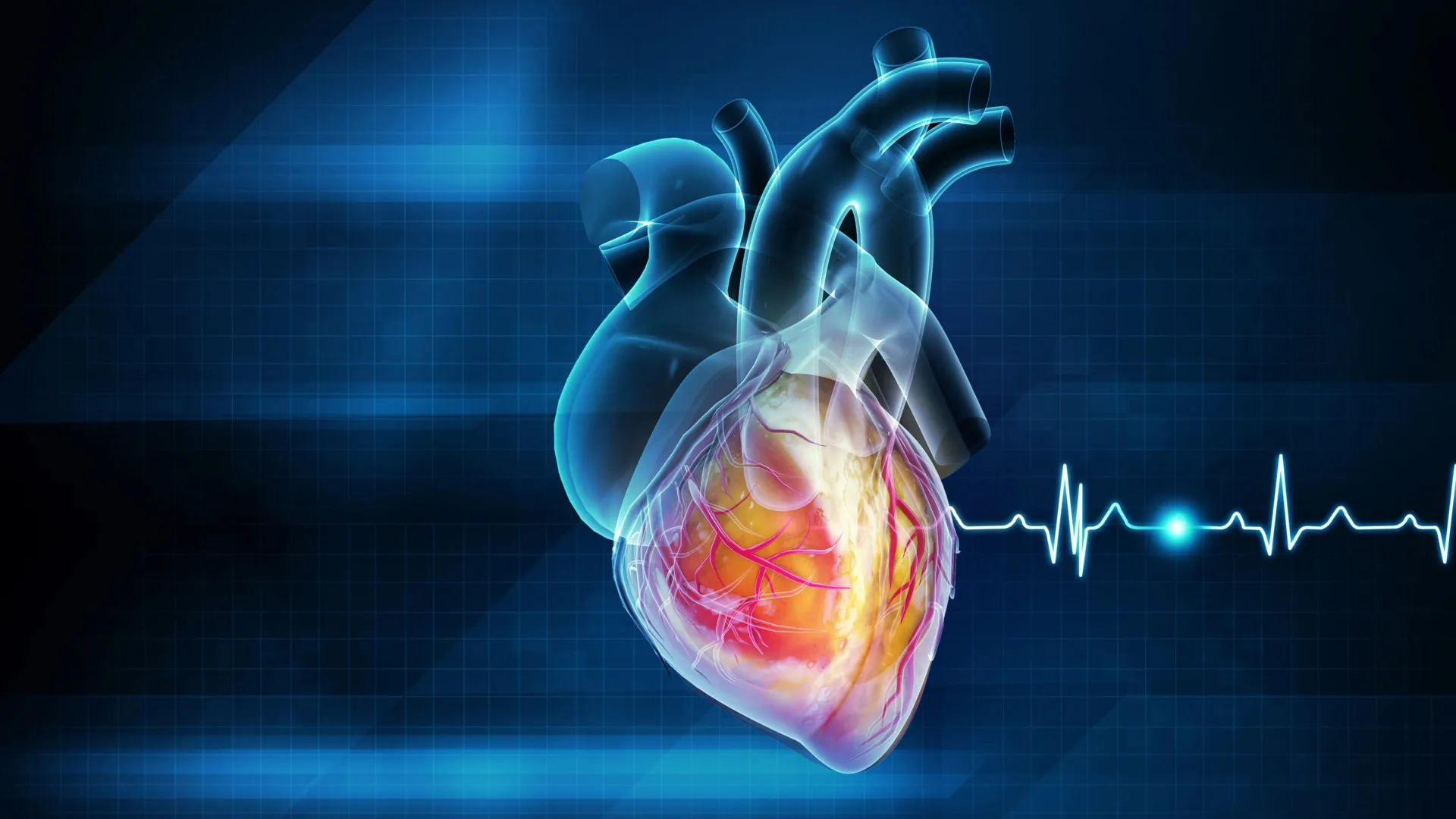 Prediabetes remission linked to lower long-term heart risk