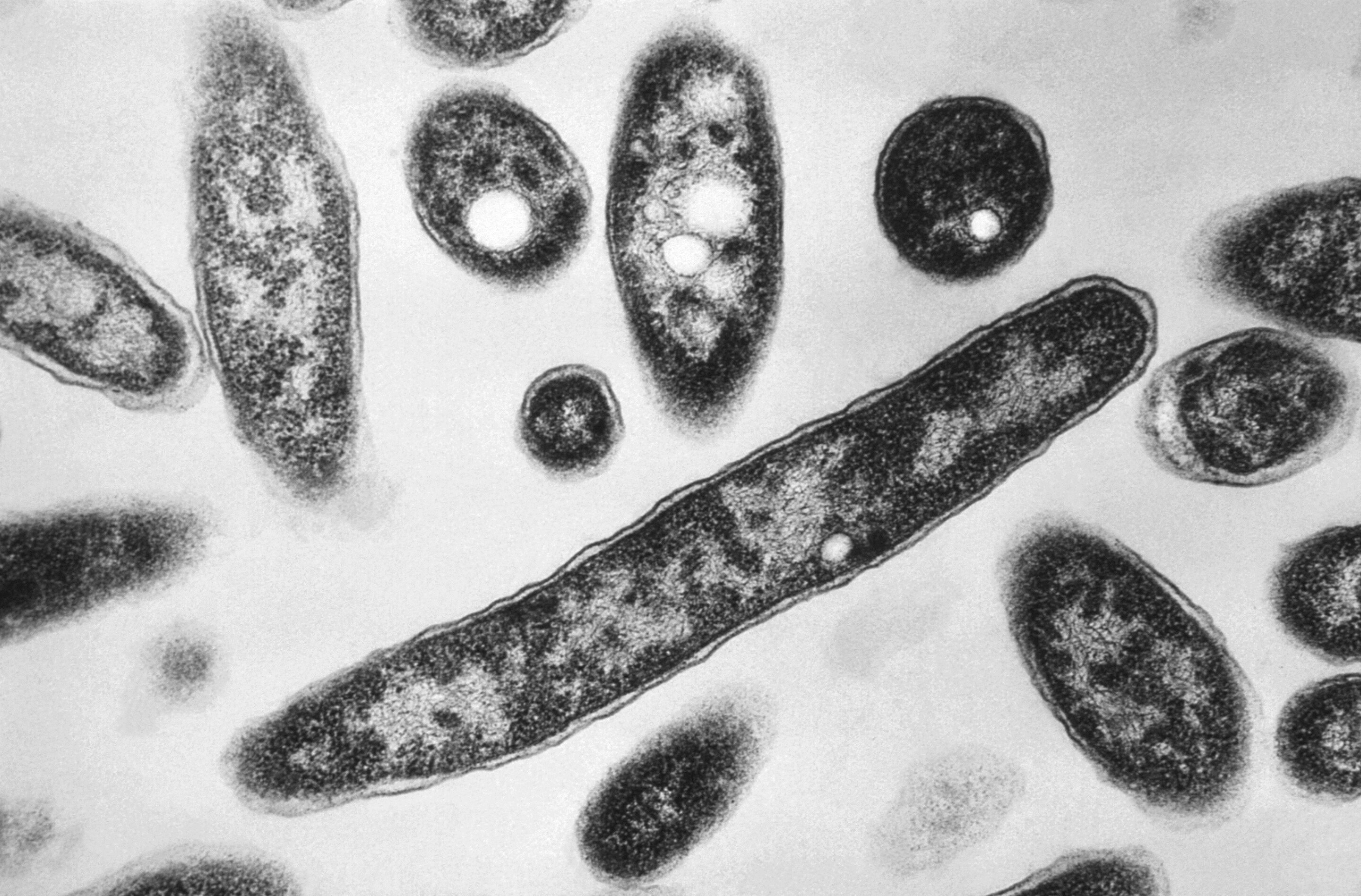 Legionnaires’ cluster sickens 23 on Manhattan’s Upper East Side