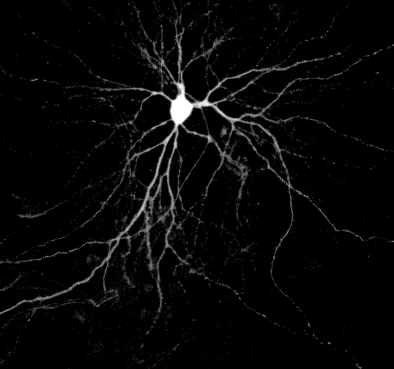 Brain protein Arc linked to tau spread in Alzheimer’s mouse study