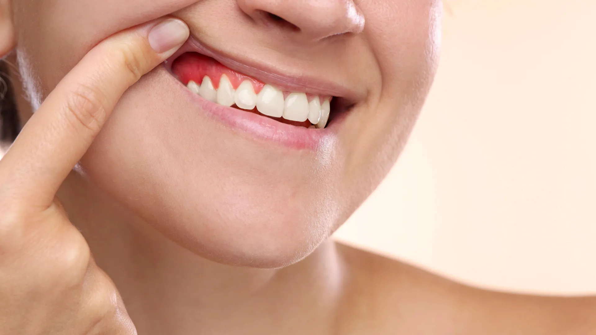 Low-calorie fasting-style diet linked to reduced gum inflammation