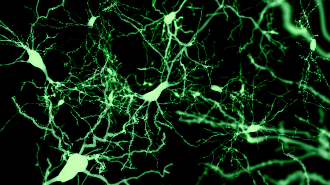Sst-Chodl neurons promote sleep in mice, study finds