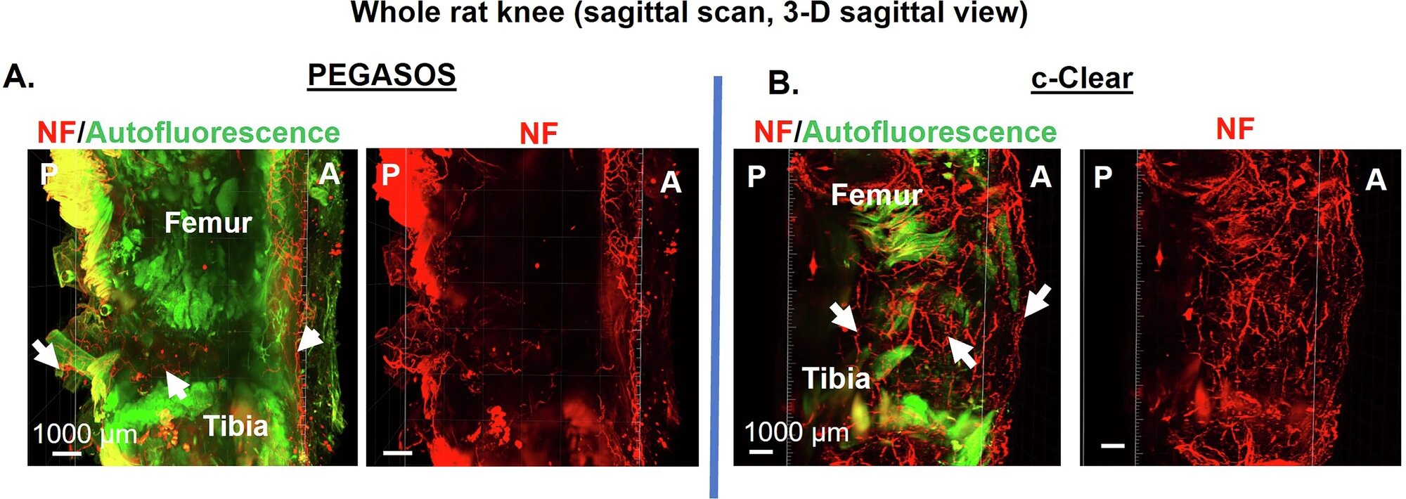 New 3D nerve maps of rat knees may aid research on jaw pain