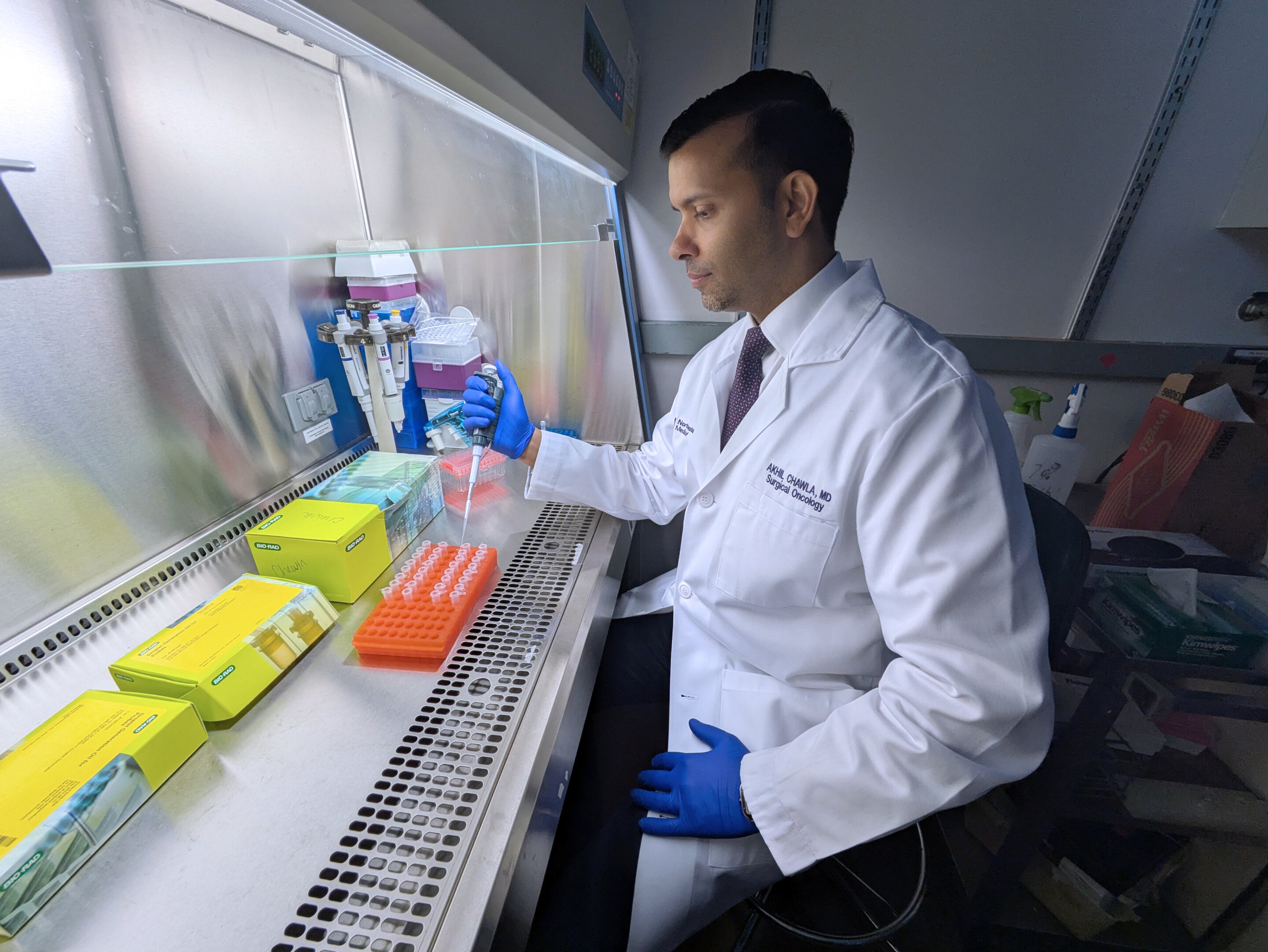 Sensitive blood test flags pancreatic cancer missed after treatment