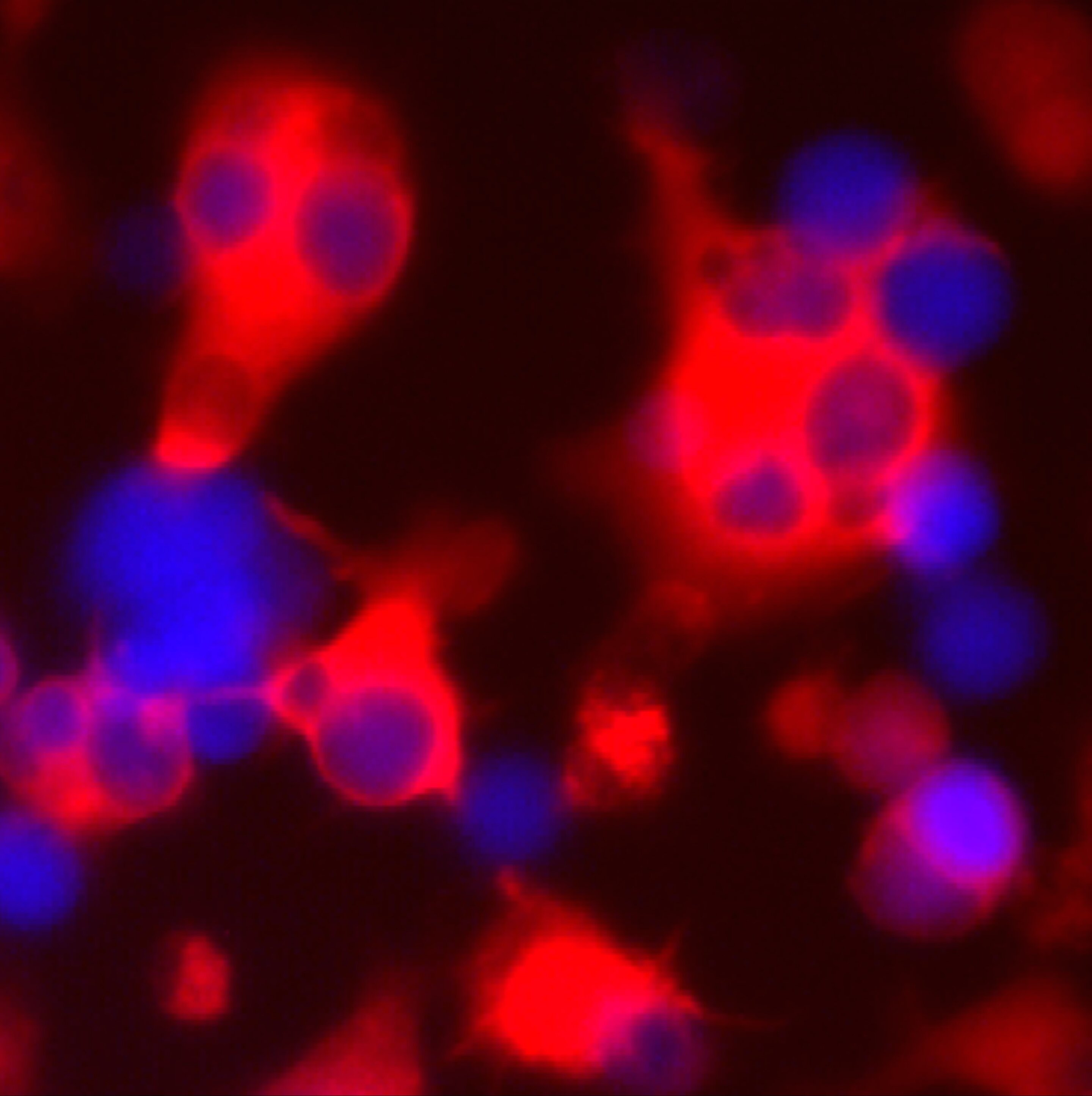 Lab-grown immune progenitors may enable off-the-shelf cancer therapy