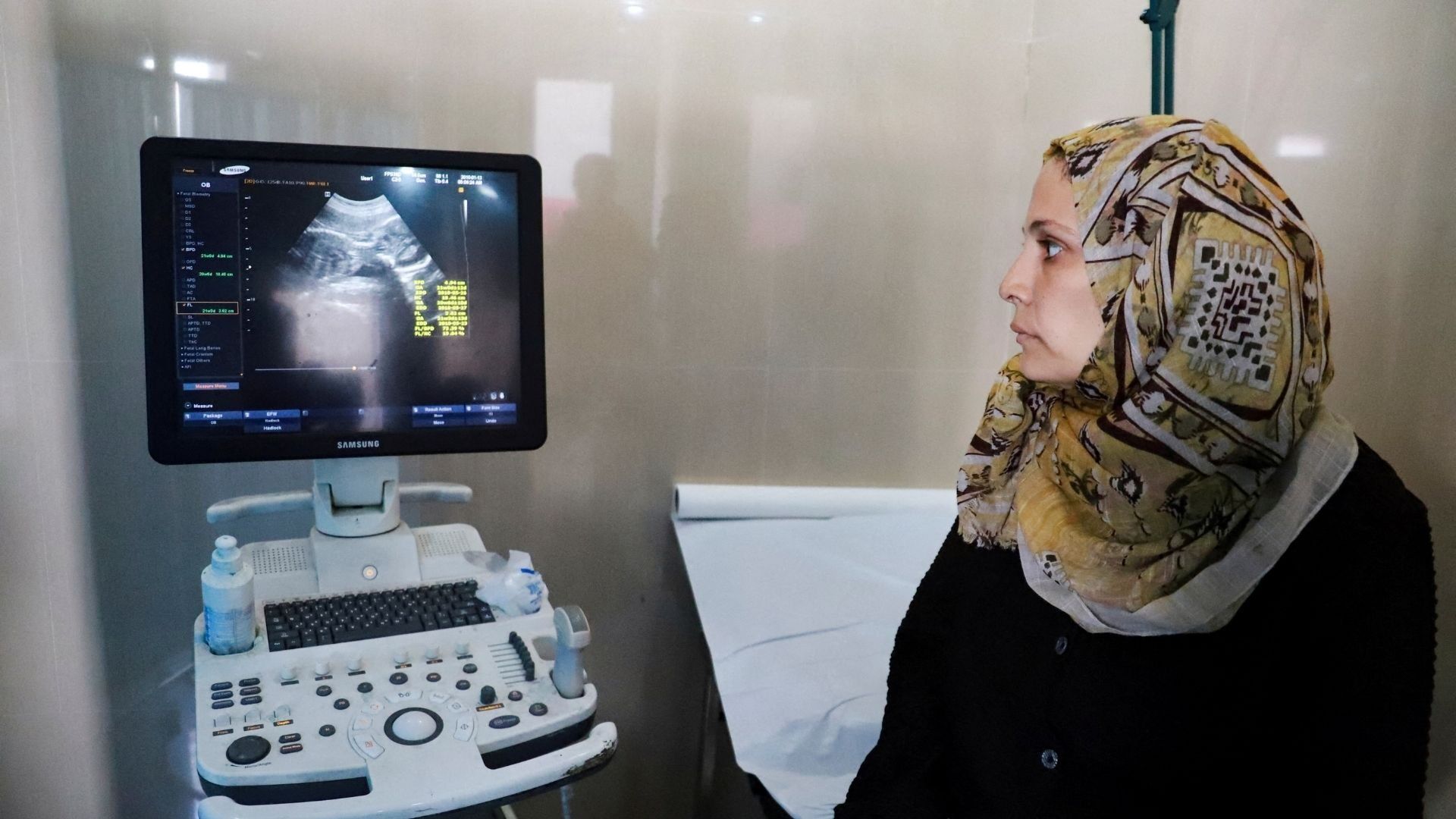 Gaza miscarriages rise as doctors point to war trauma and hunger