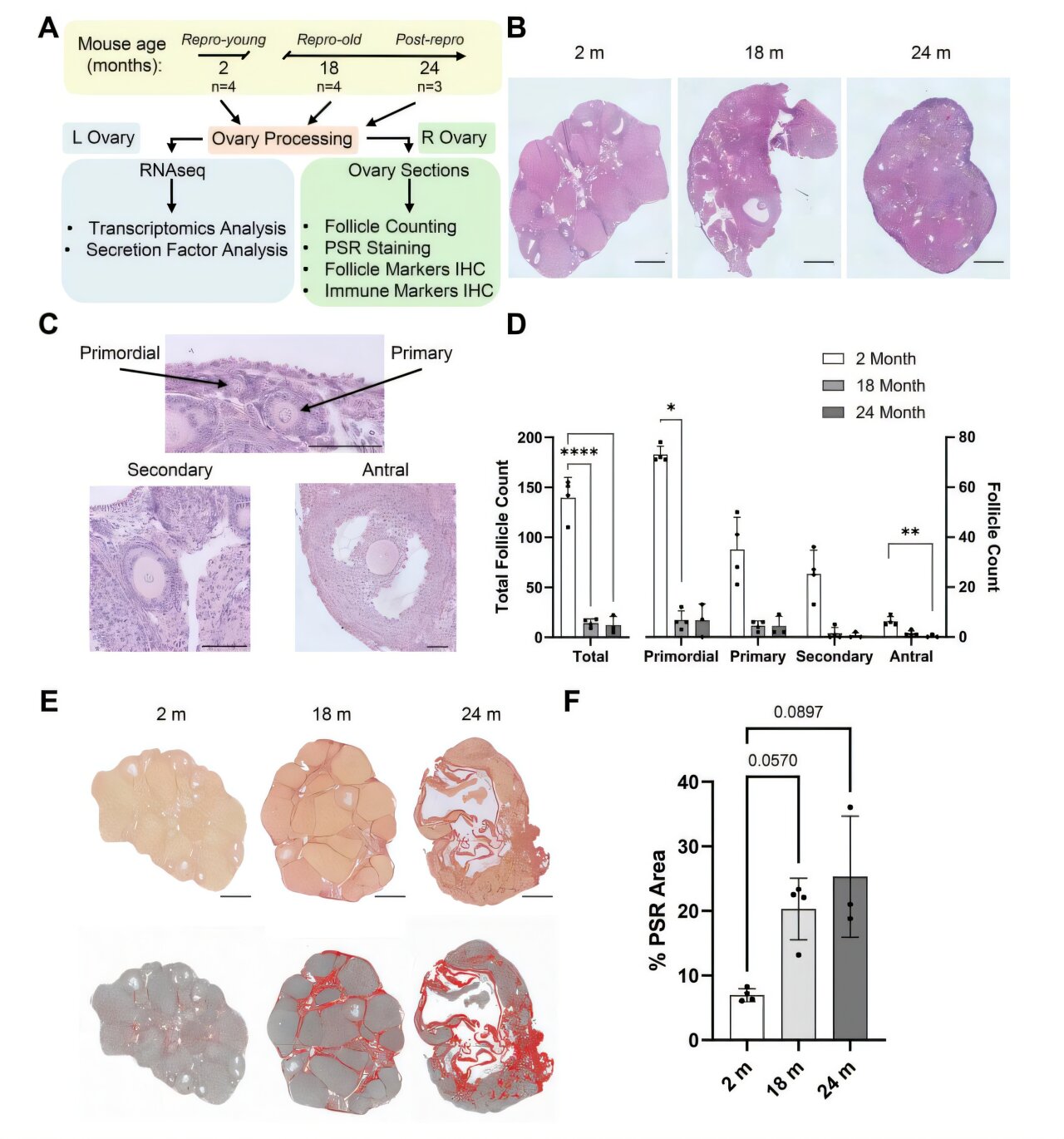 Mouse study suggests aging ovaries shift toward immune activity