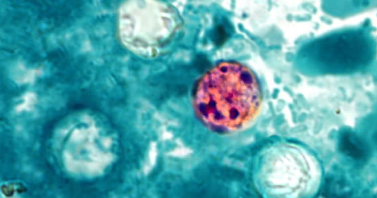 Michigan officials eye lettuce in cyclosporiasis outbreak