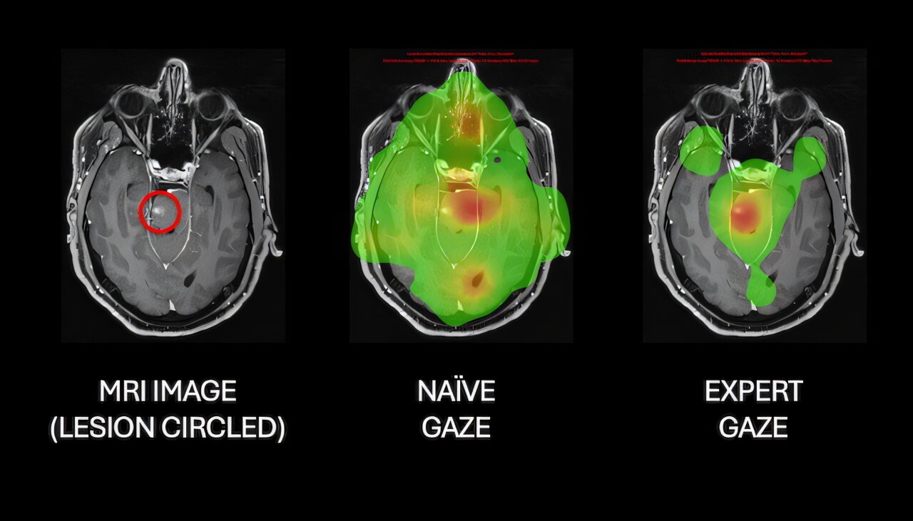 Neurosurgeon eye tracking AI research maps expert scan reading