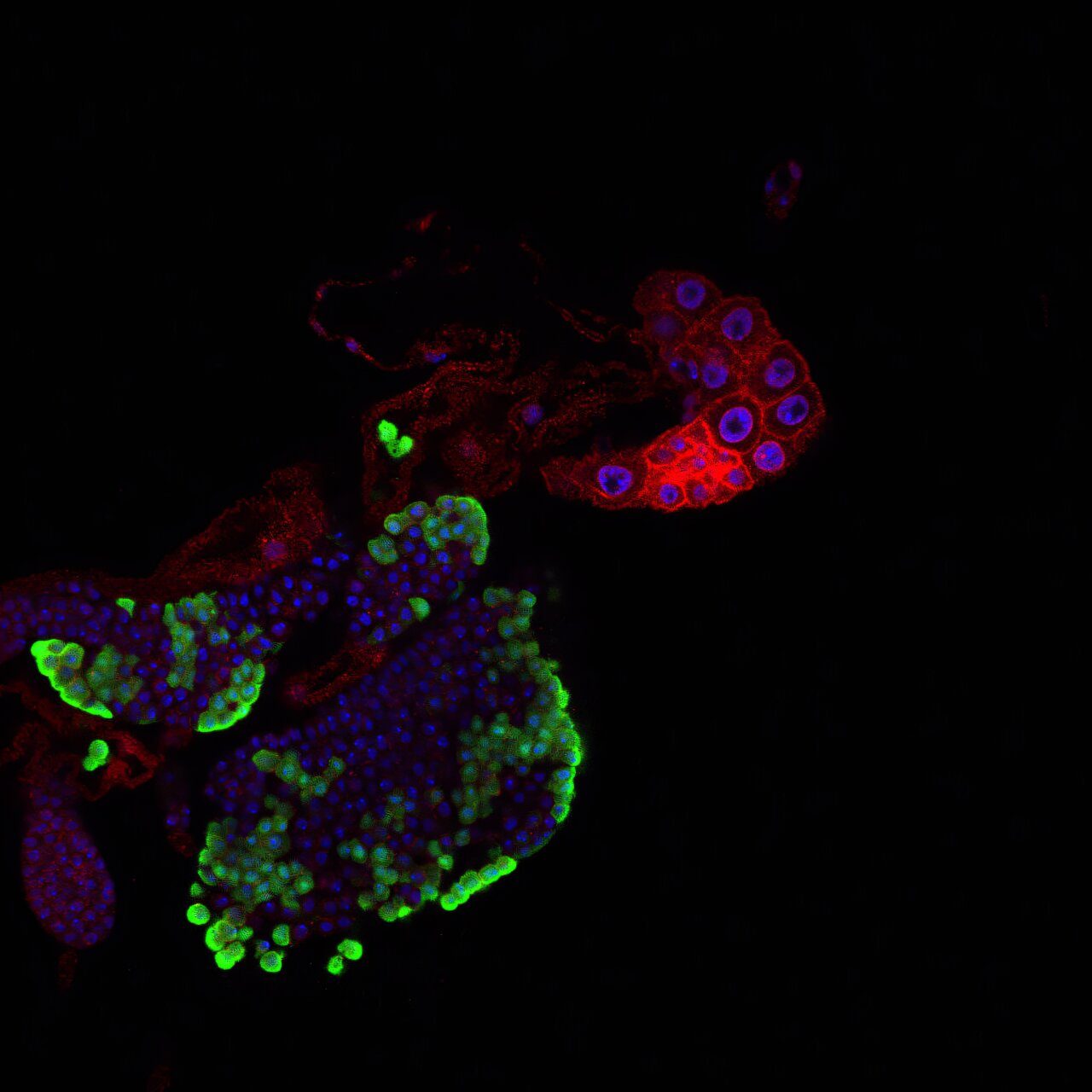 Fruit fly study ties immune cells to sugar-related growth timing