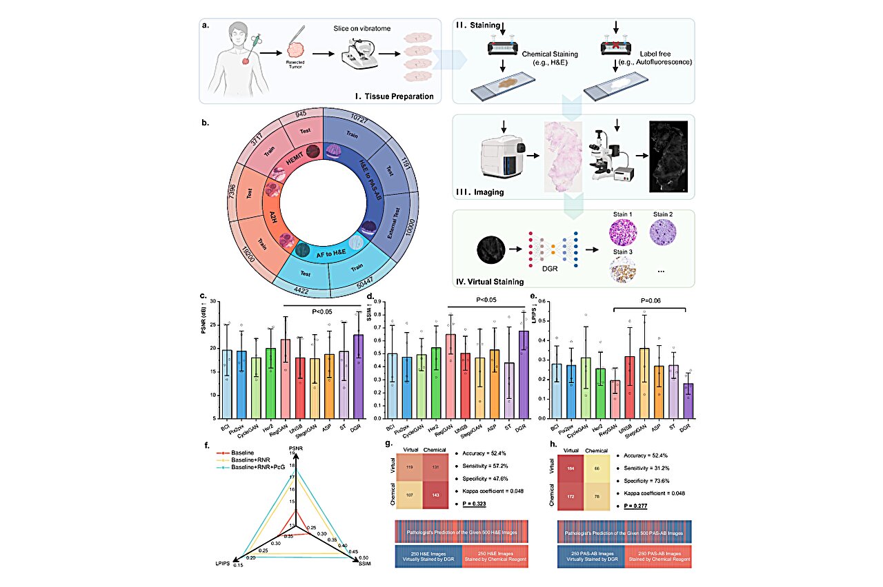 AI method produces pathology stains despite imperfect slide alignment