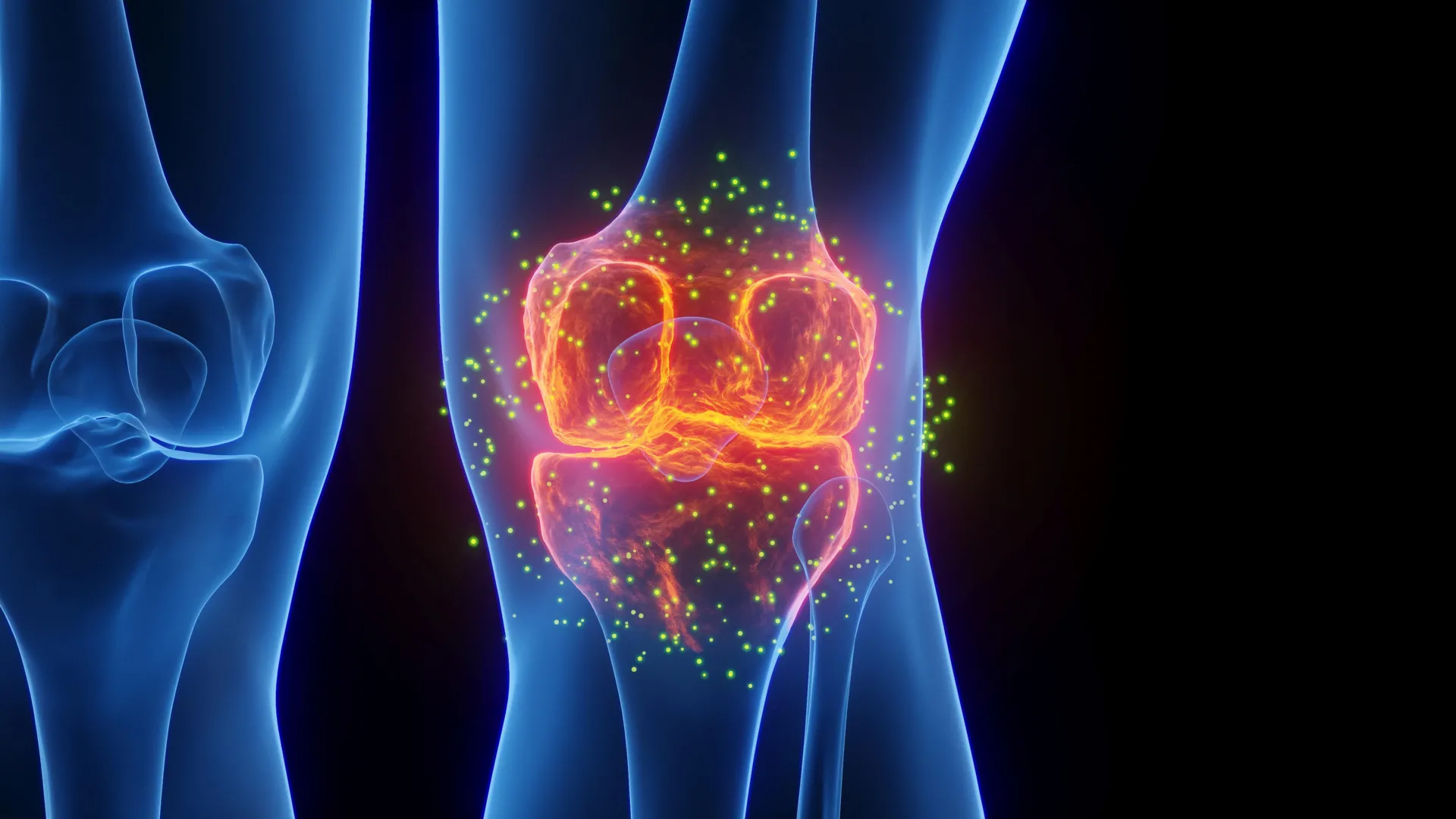 Stanford team reports cartilage regrowth in mice after blocking aging-linked protein