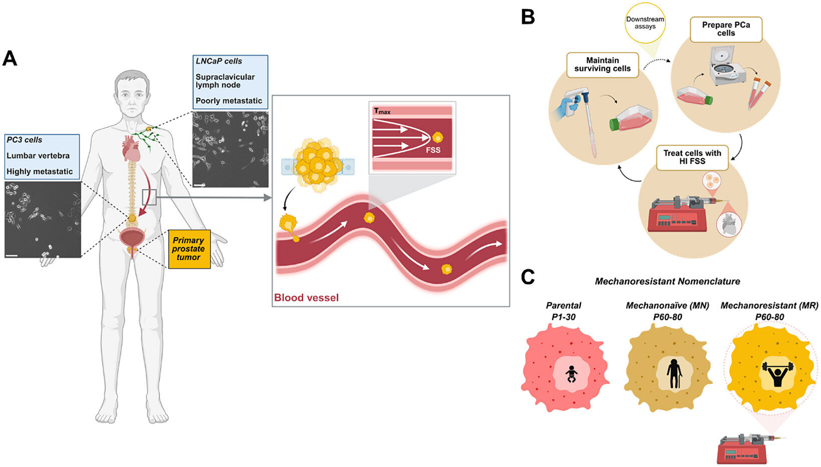 Mechanoresistant cancer cells reveal CALB2 link in prostate cancer study