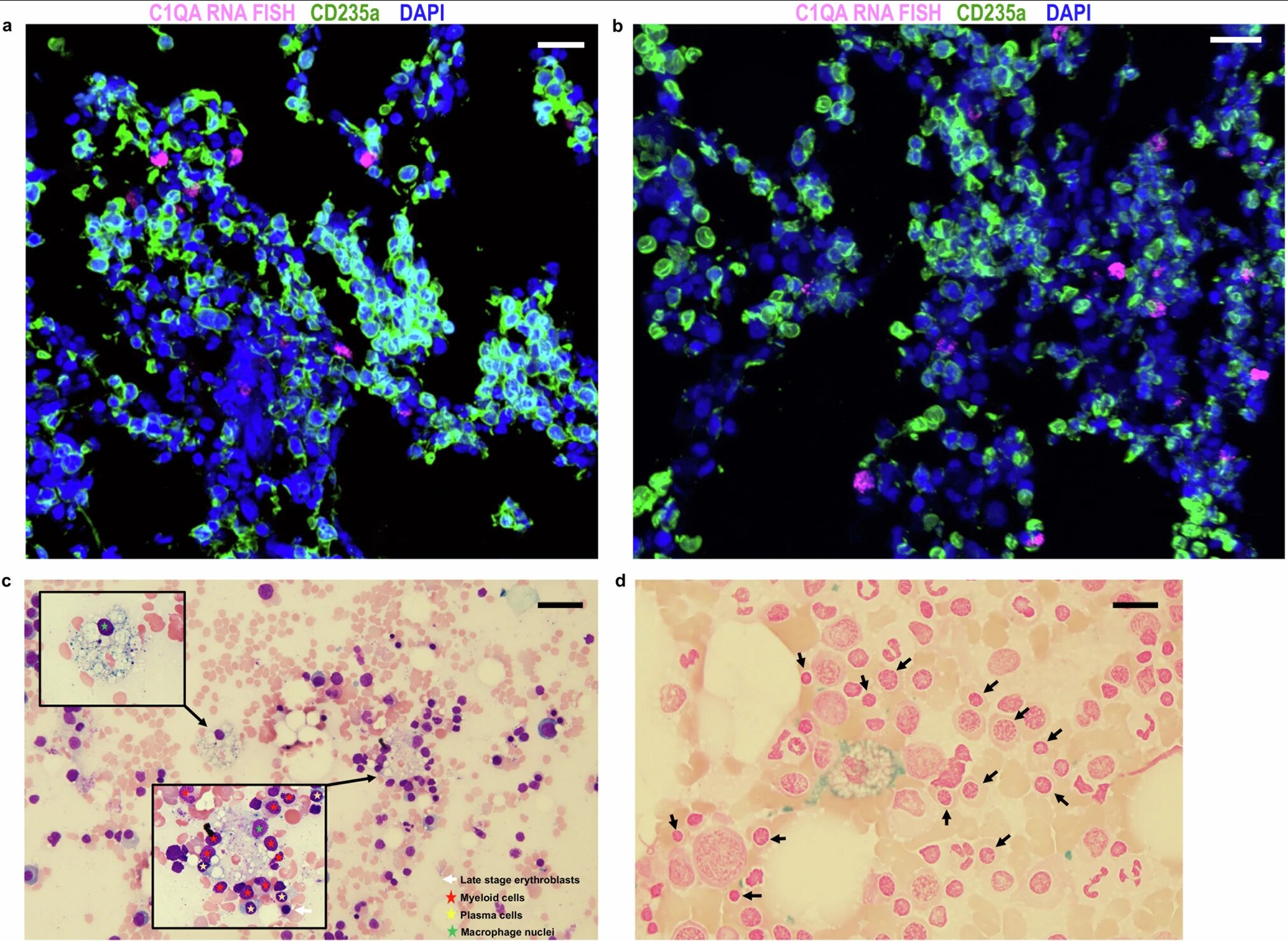 Human red blood cell development differs from mouse model, study finds