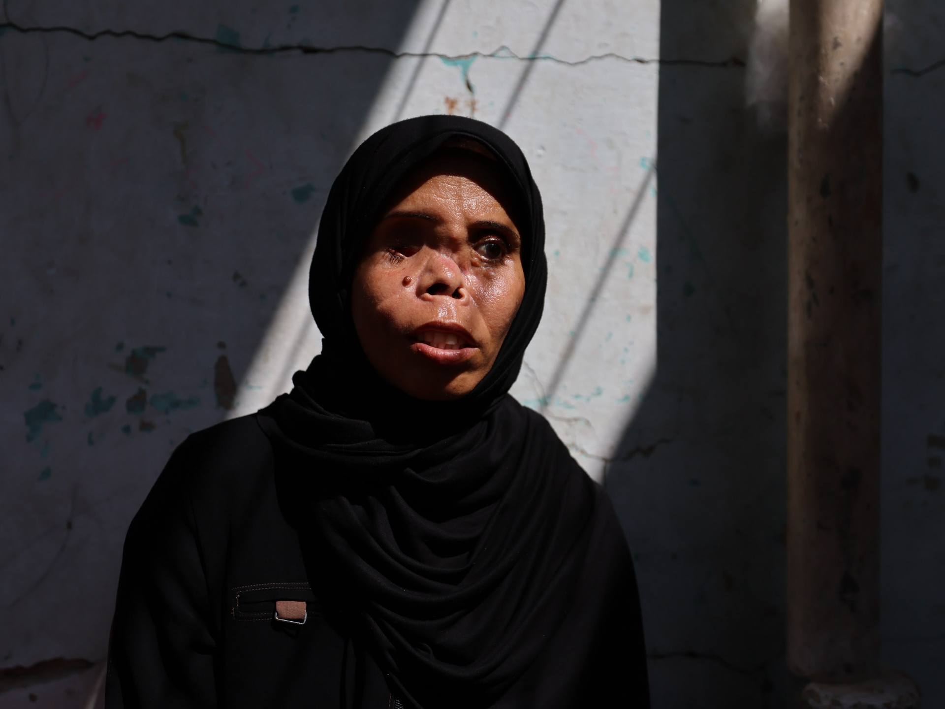 Gaza woman awaits treatment after strike killed daughter and cost her an eye
