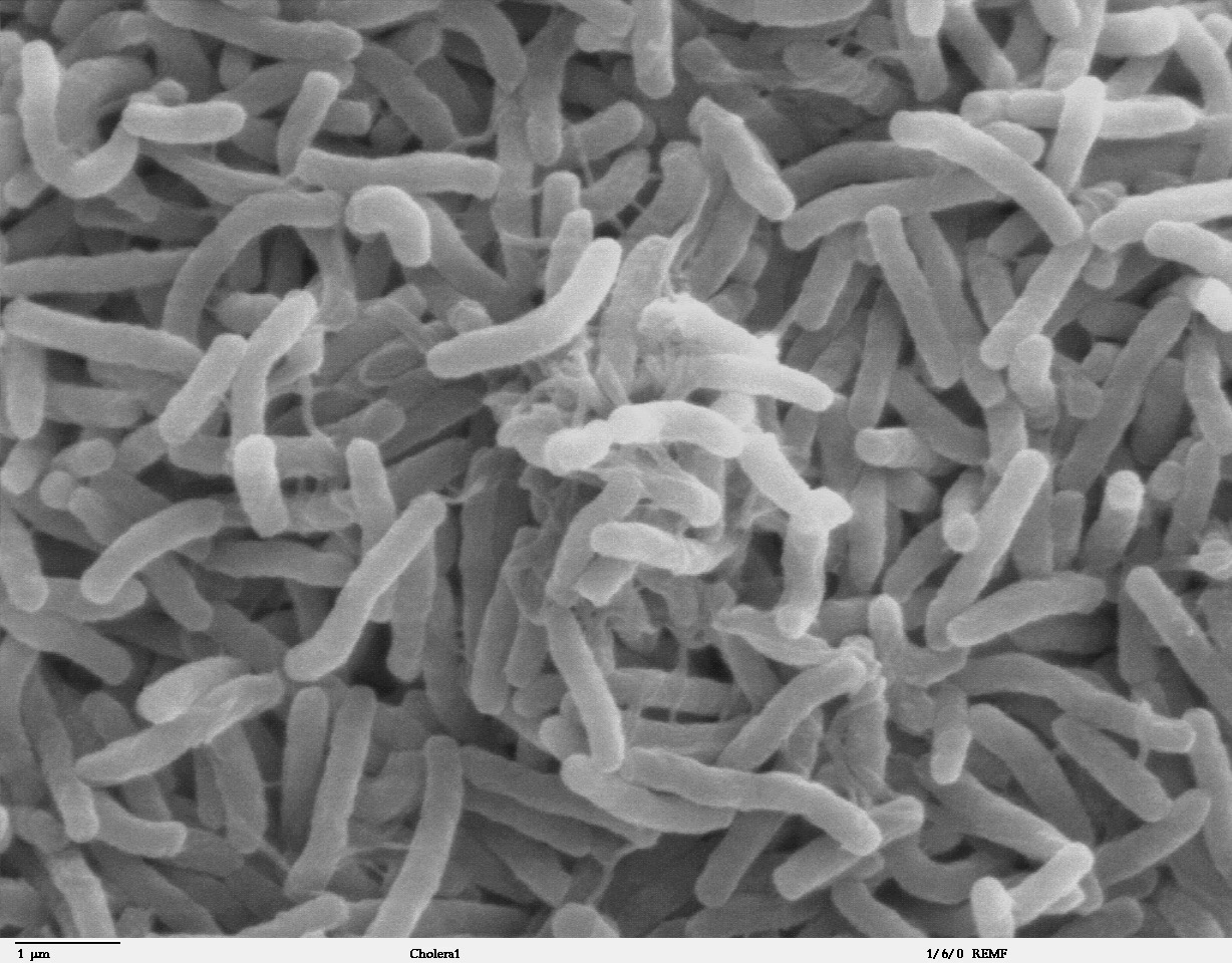 Cholera deaths worldwide rise as clean water gaps persist