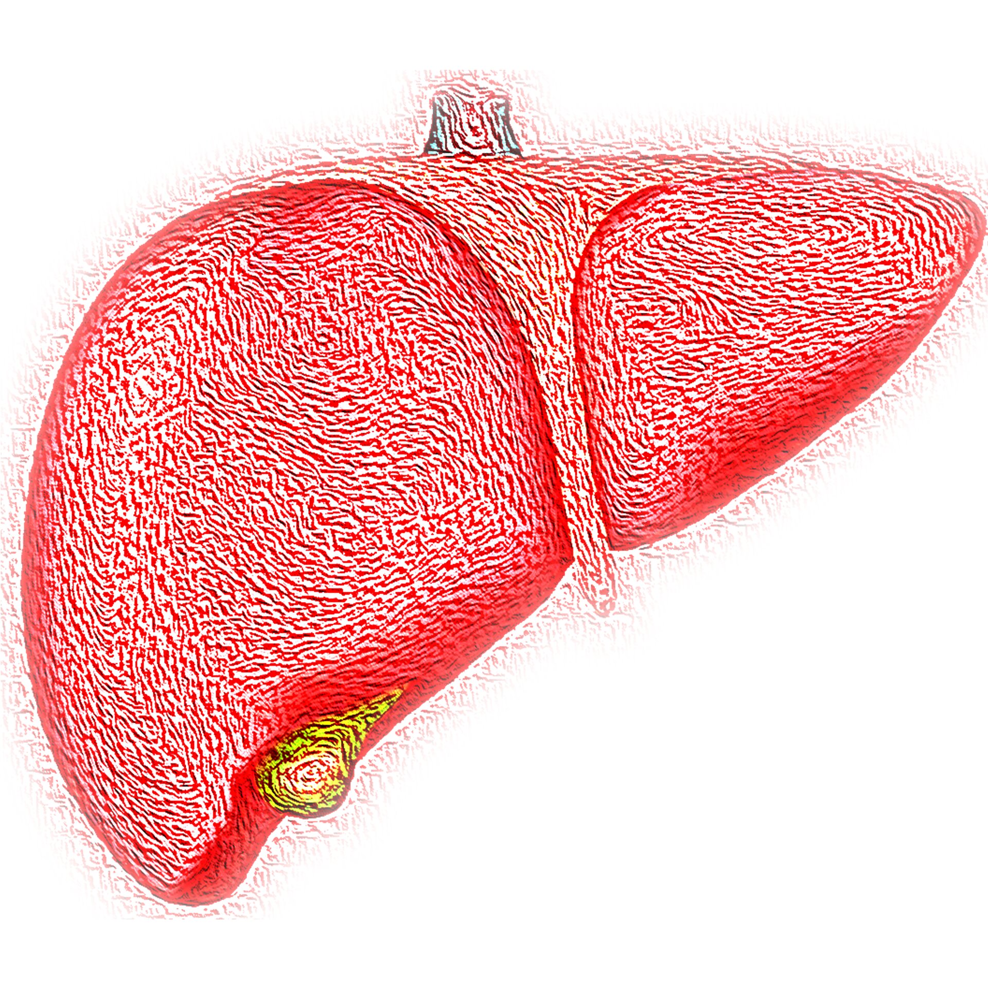 Study identifies liver pathway that may raise LDL cholesterol