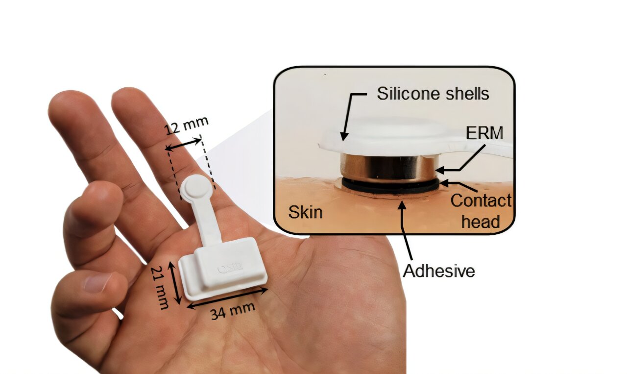 Lymphedema skin sensor could help track tissue changes at home