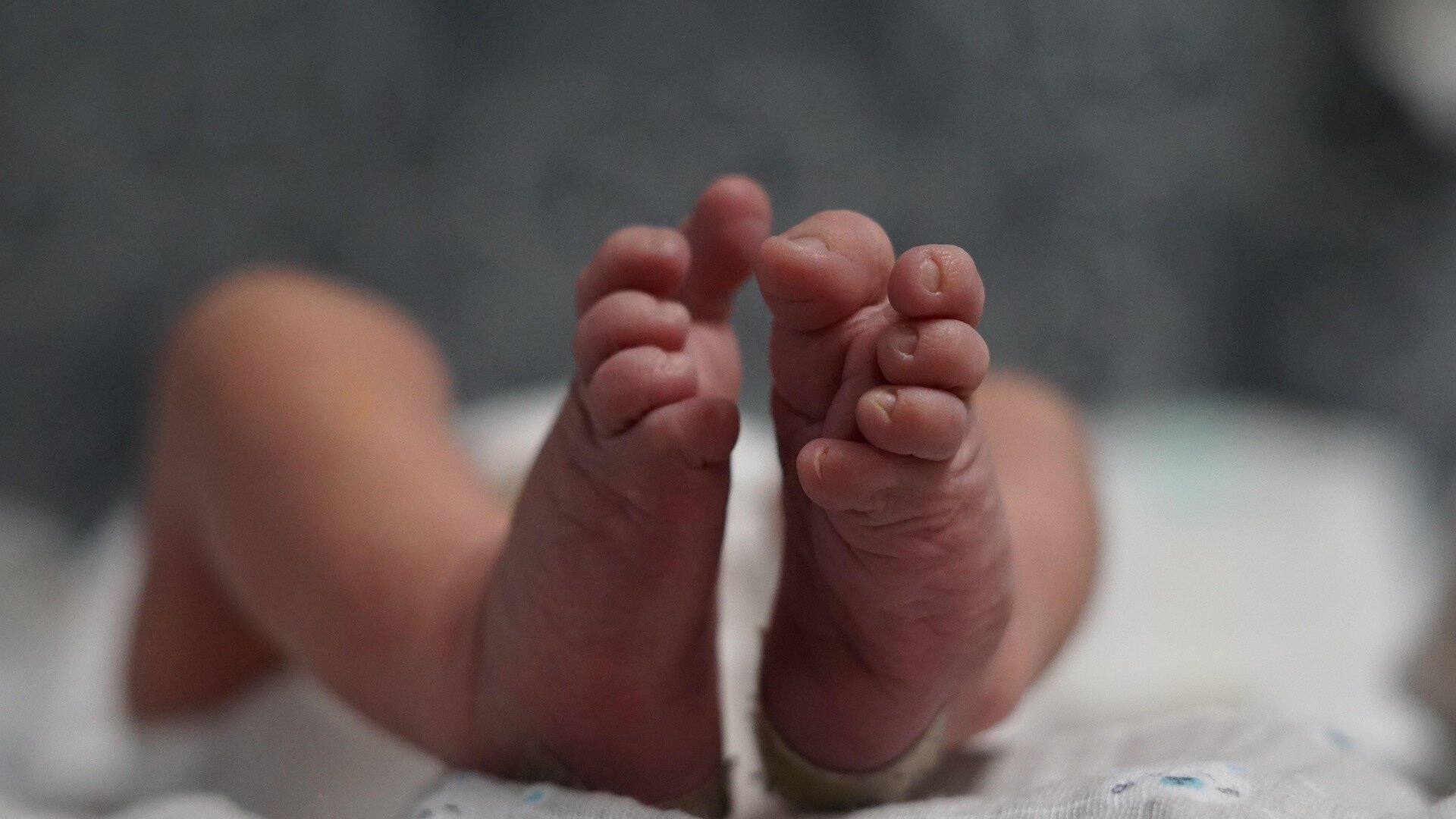 Premature babies’ growth may be tied to brain abnormalities, study finds