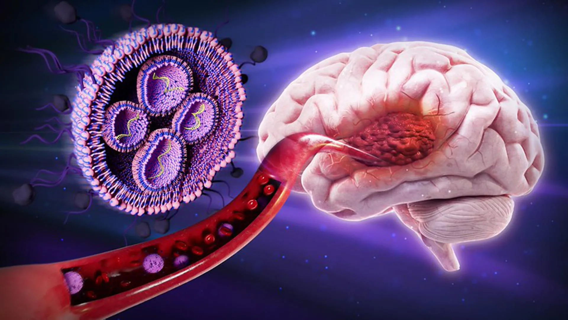 Sugar-coated nanoparticles slow brain tumors in mouse study