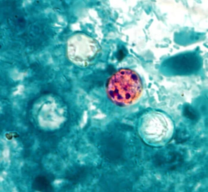 Michigan investigates more than 700 Cyclospora cases