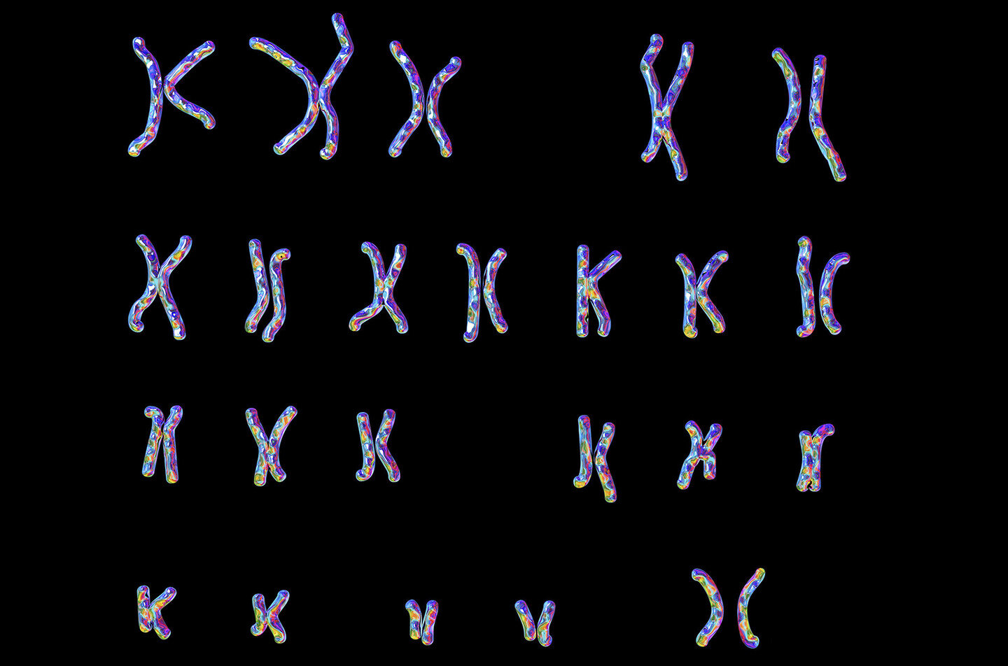 Studies link X chromosome silencing failures to lupus mechanisms