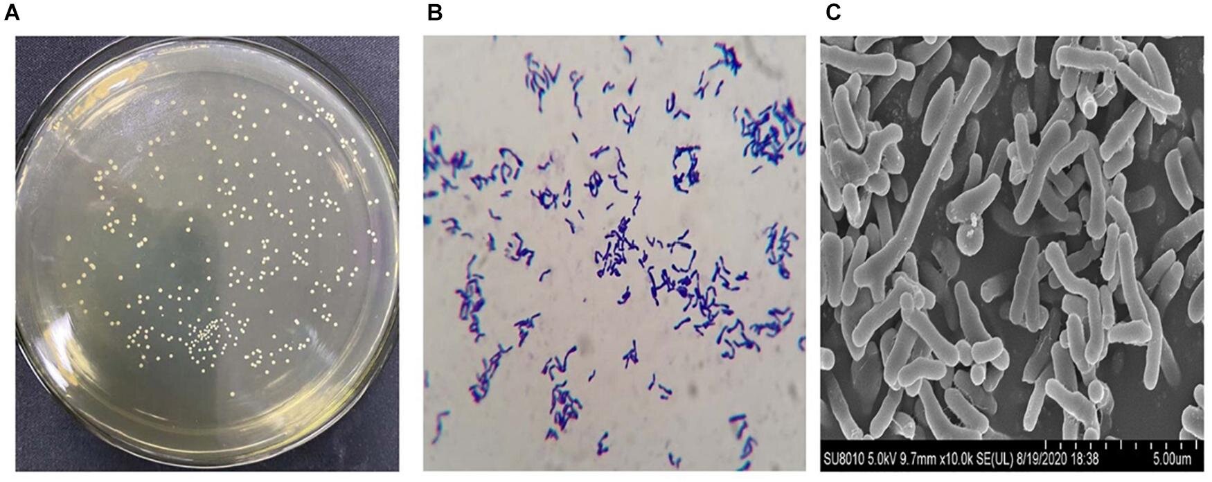 Engineered gut bacteria pancreatic cancer therapy works in animal study