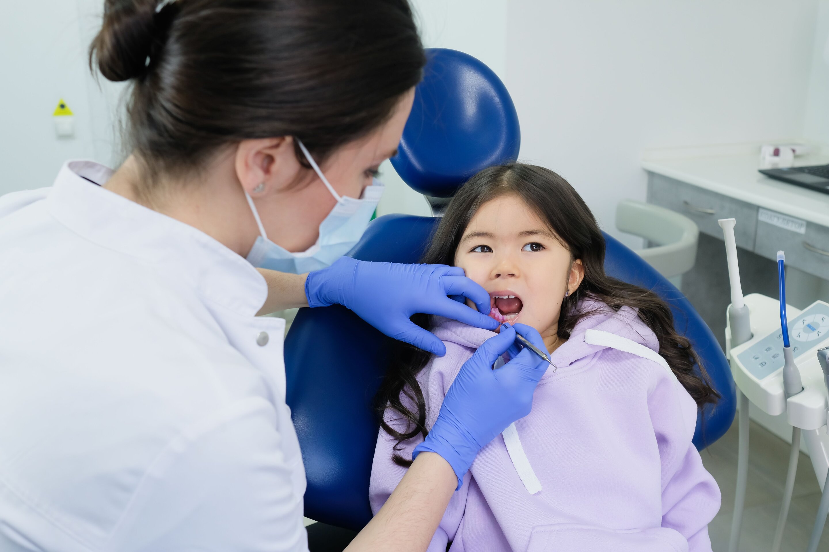 Silver diamine fluoride cavities study backs drill-free care for kids