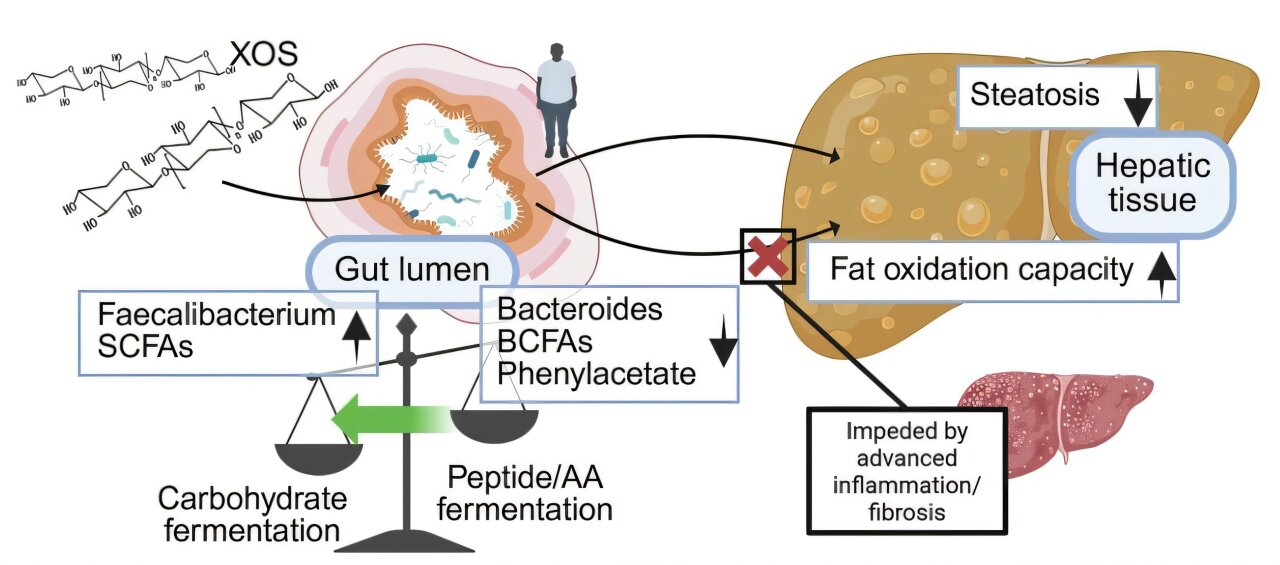 Fiber prebiotic tied to liver benefits in small fatty liver trial
