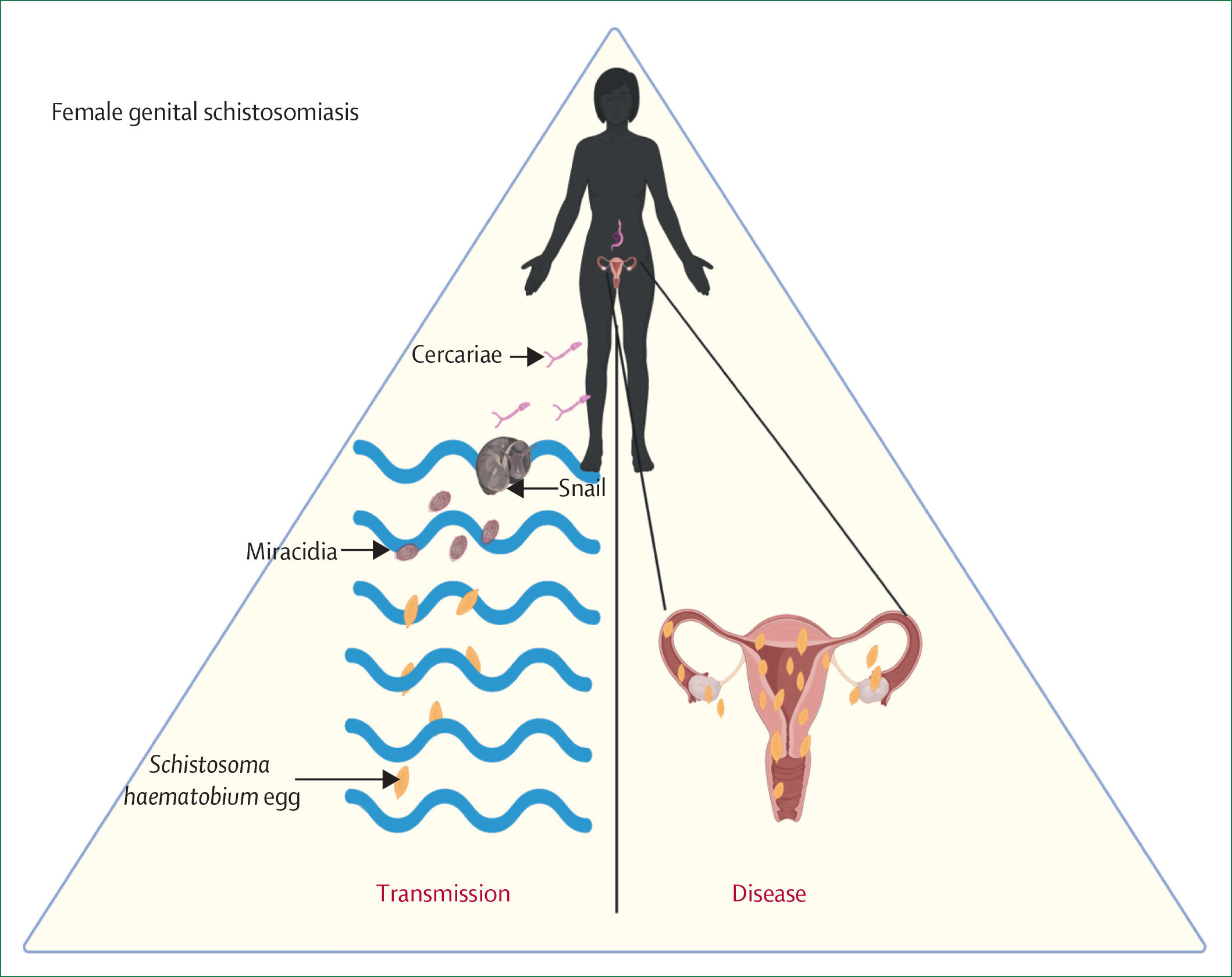Researchers urge routine screening for neglected genital parasite disease